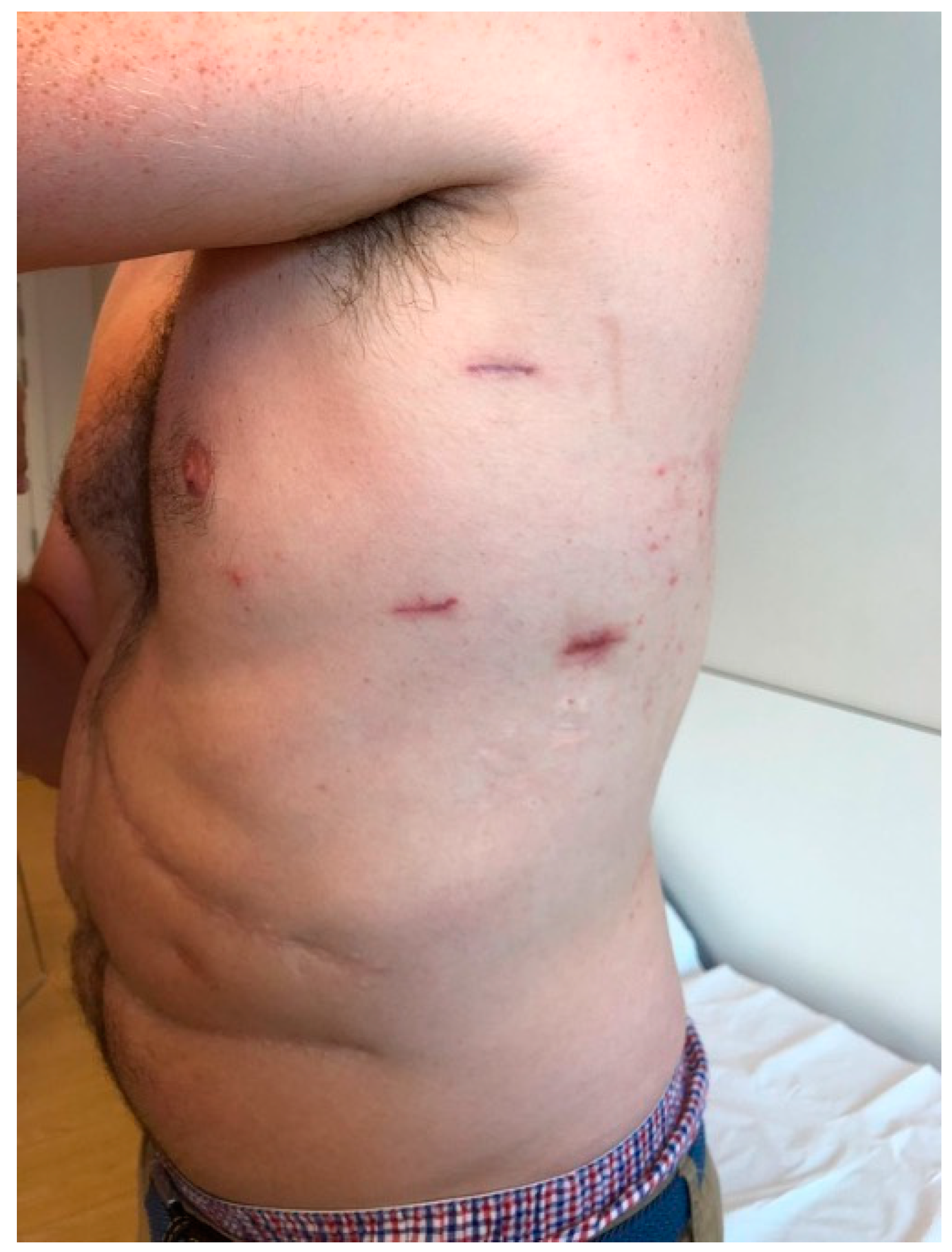 Surgeries 02 00014 g006