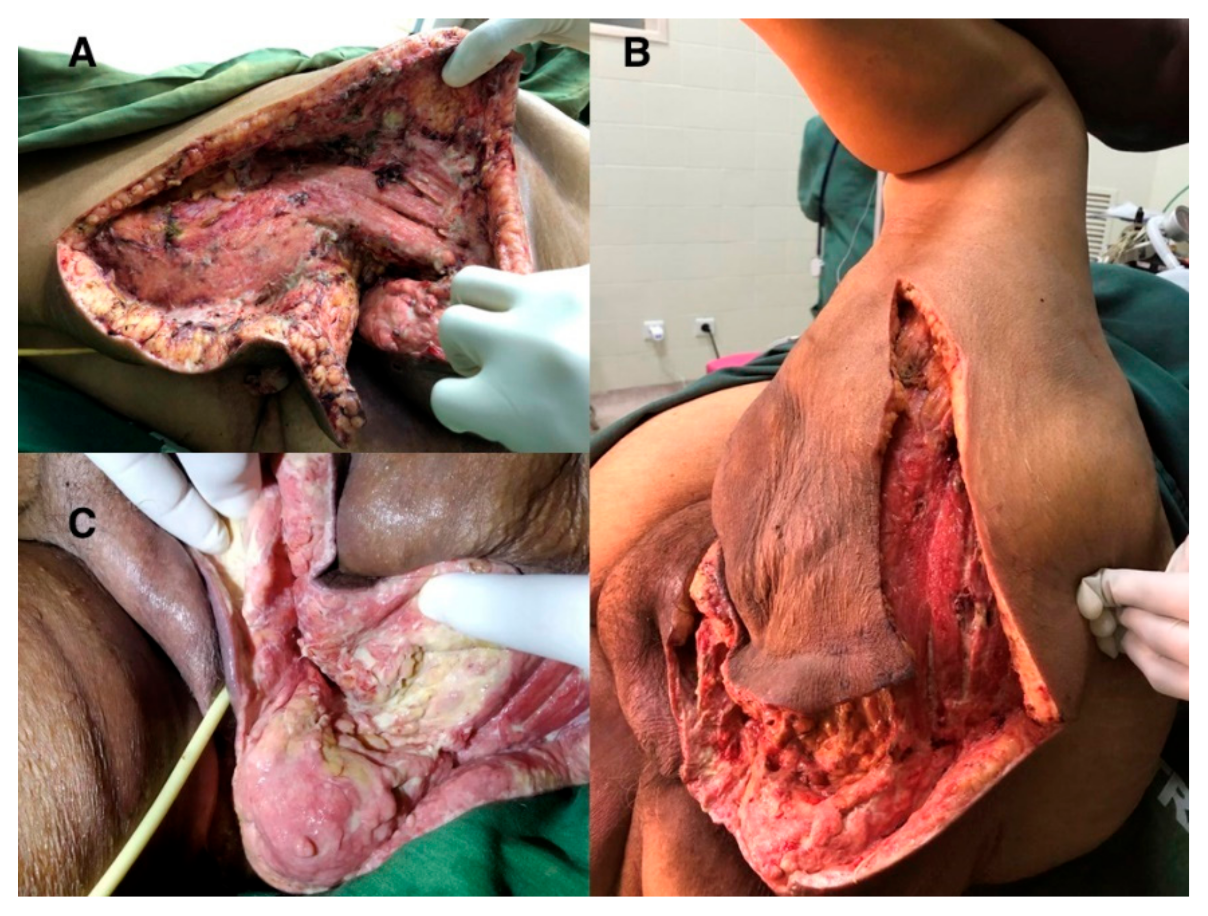 Surgeries 02 00018 g001