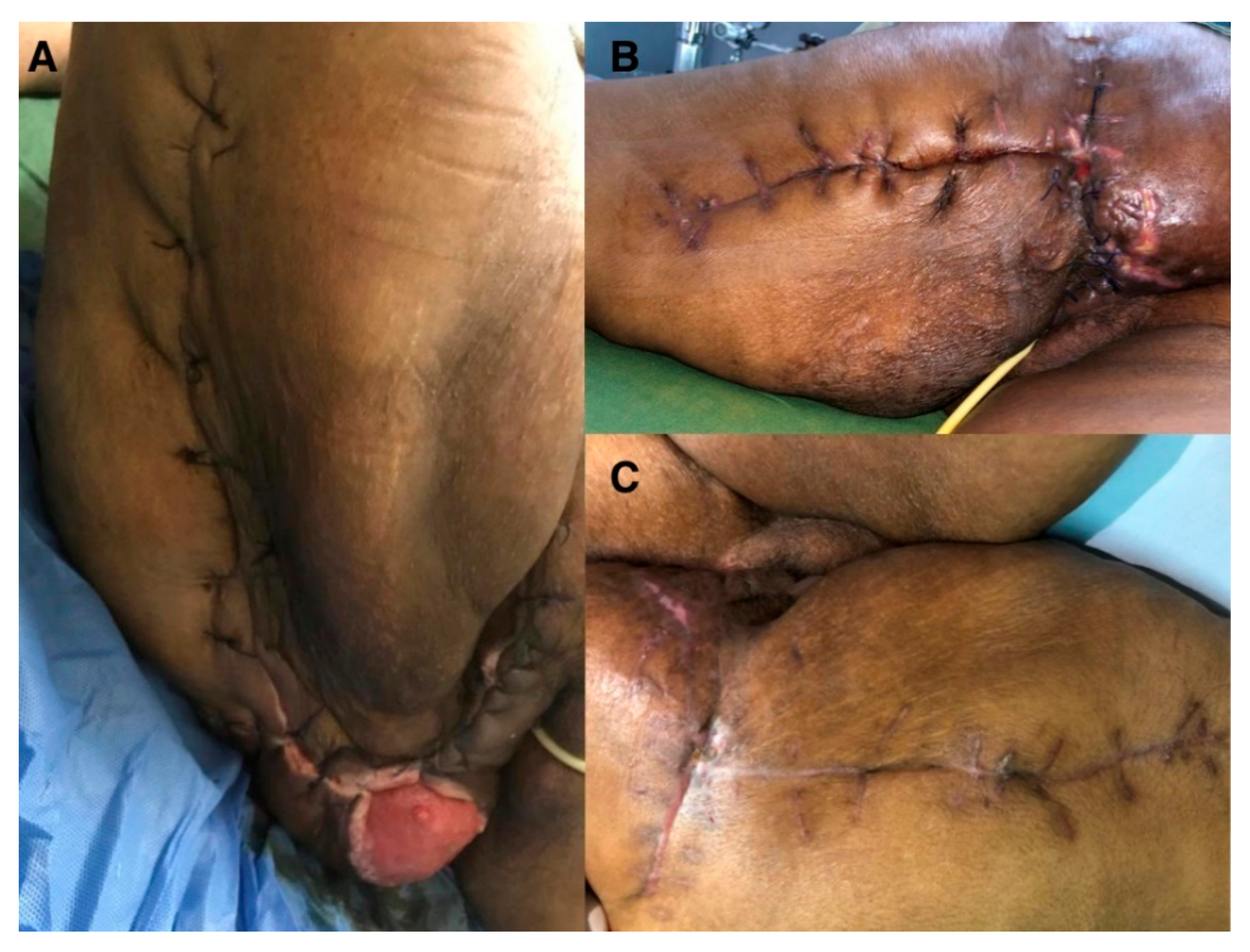 Surgeries 02 00018 g002