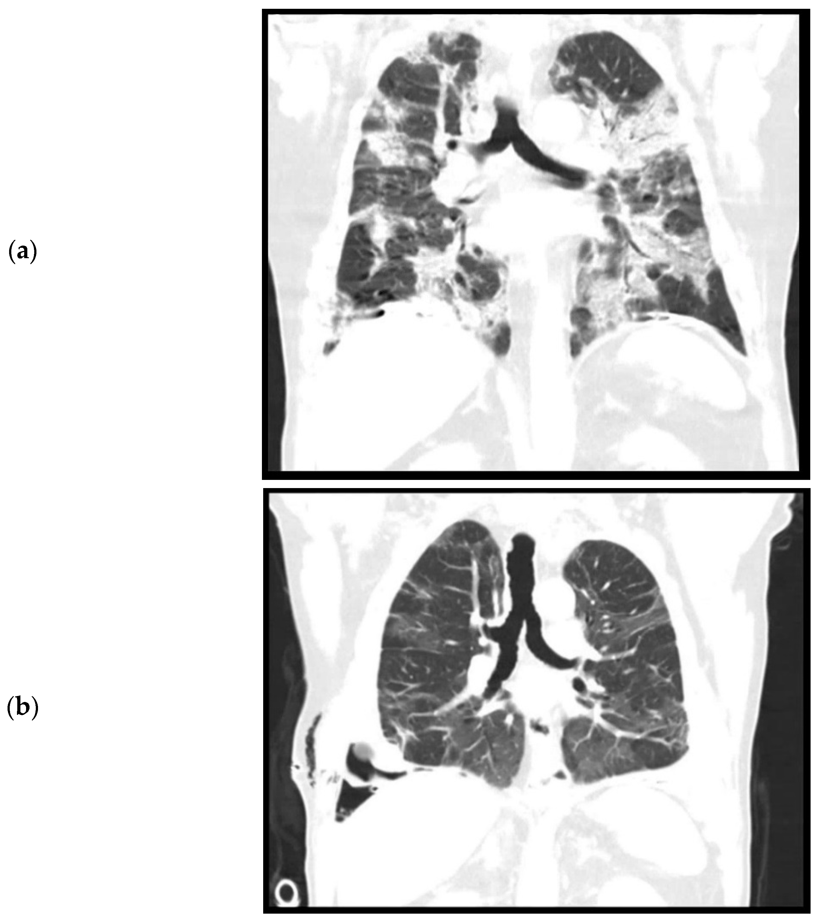 Surgeries 02 00020 g001a