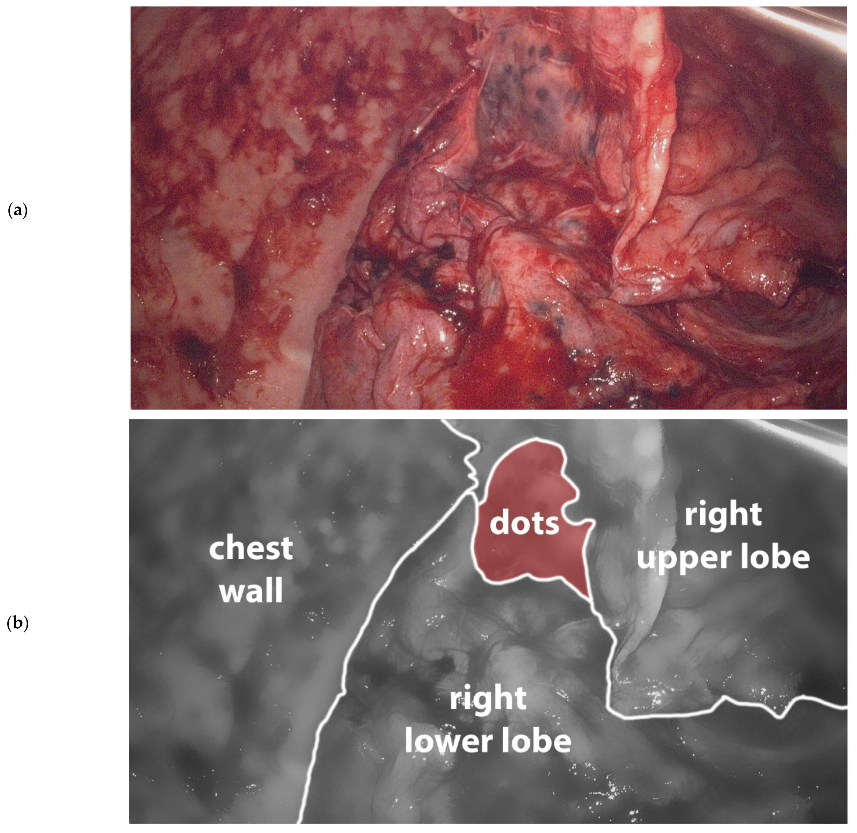 Surgeries 02 00020 g002