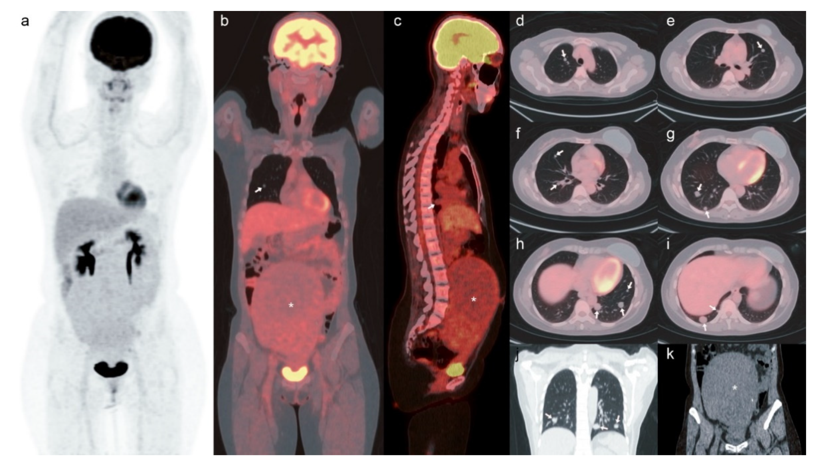 Surgeries 02 00023 g001