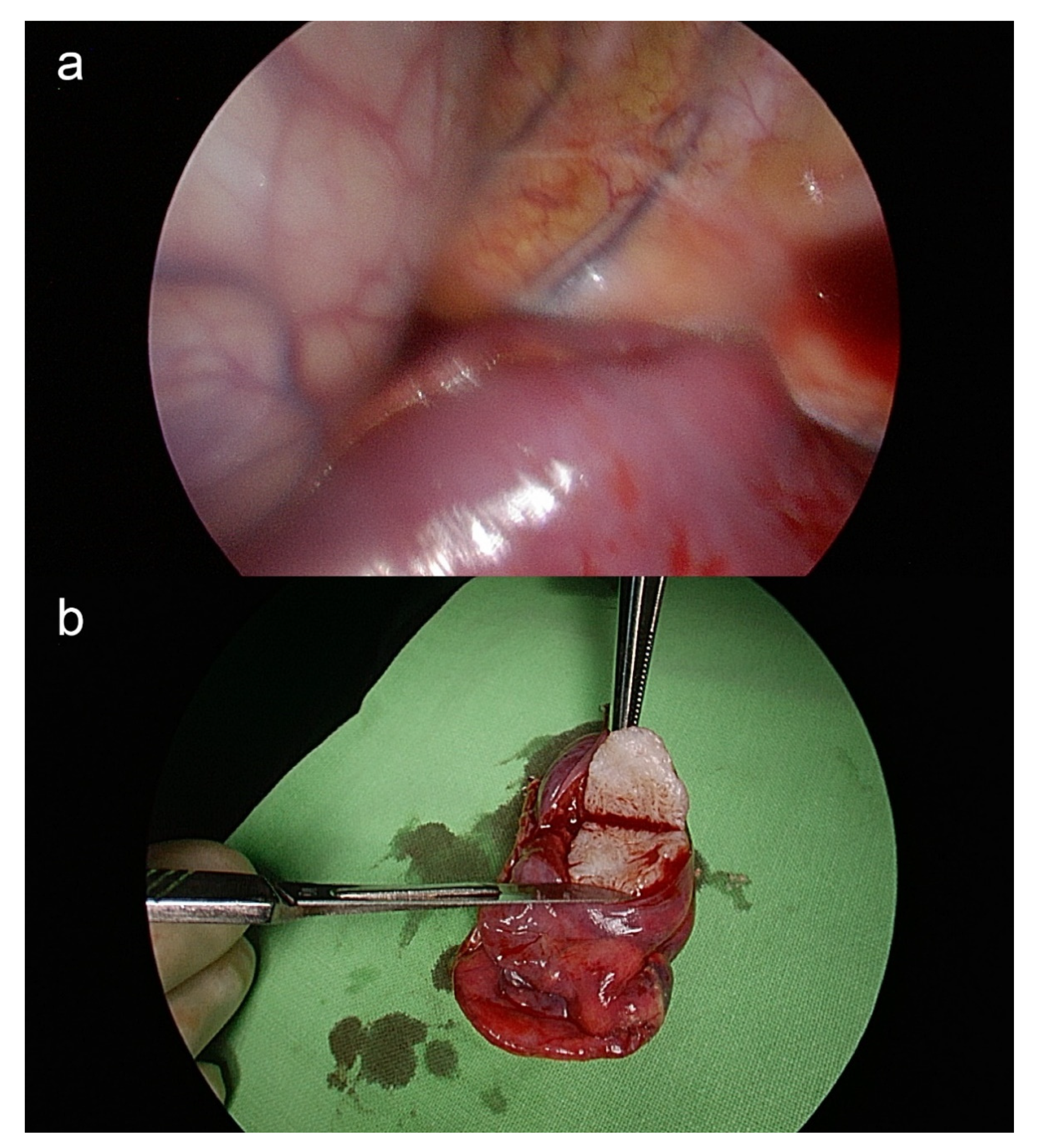 Surgeries 02 00023 g002