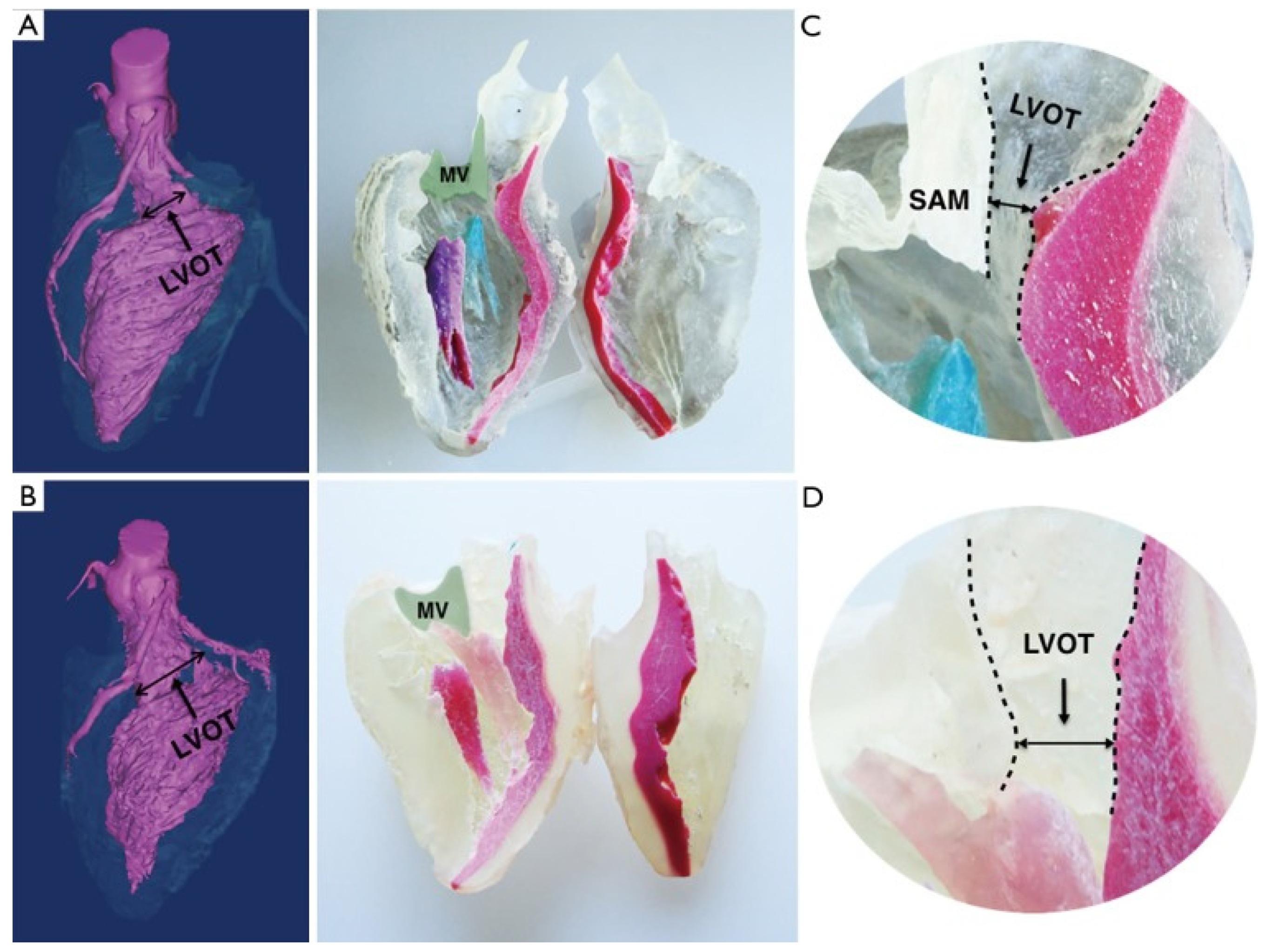 Surgeries 02 00025 g002