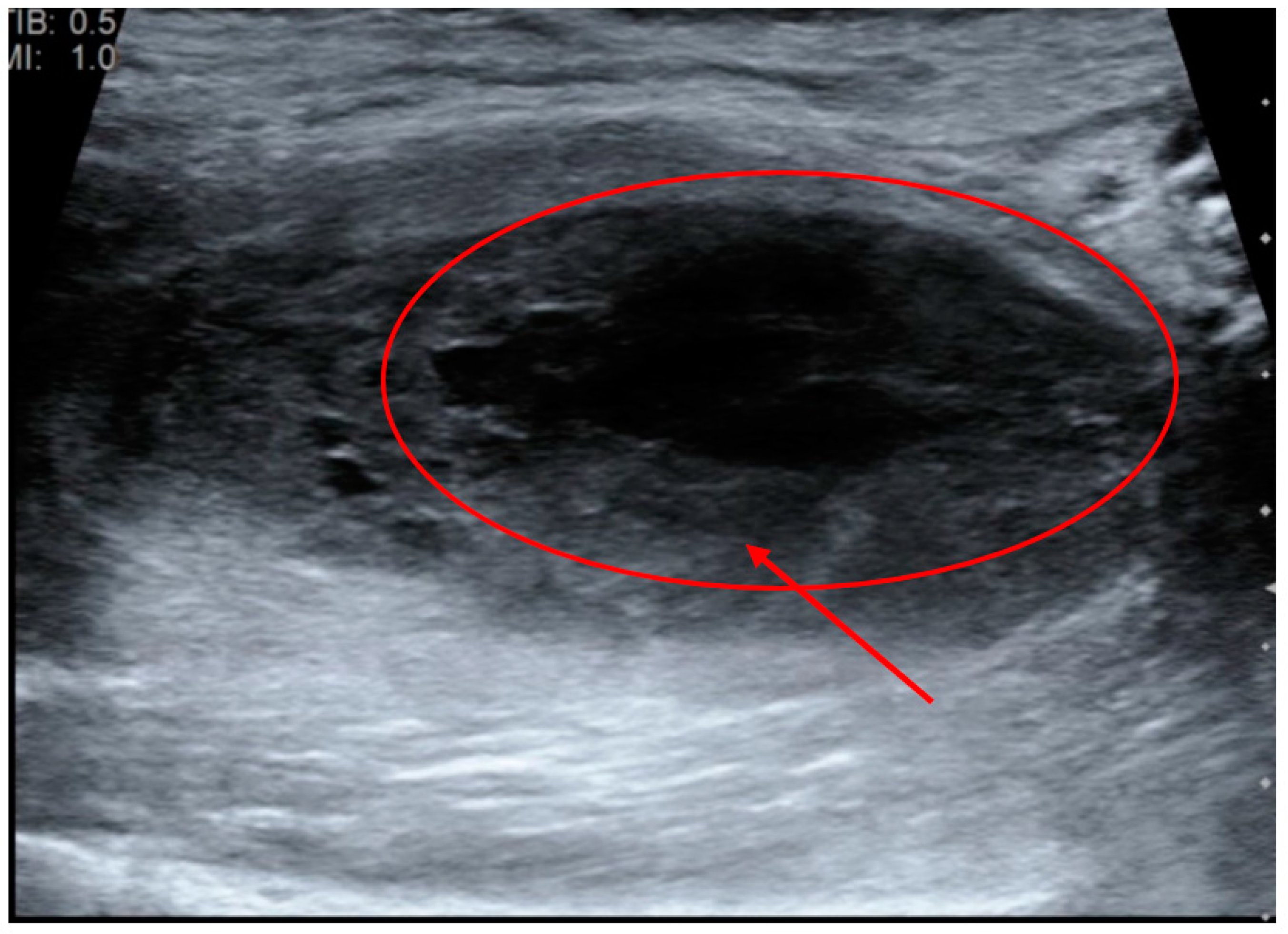 Surgeries 02 00032 g001