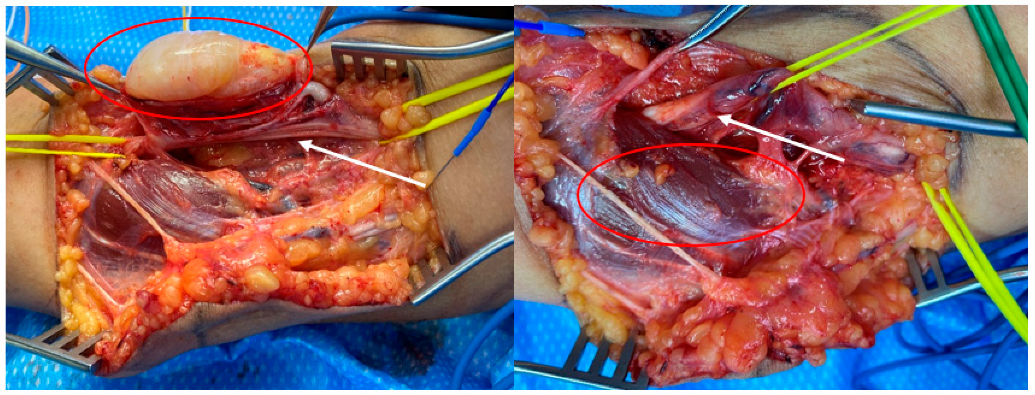 Surgeries 02 00032 g002