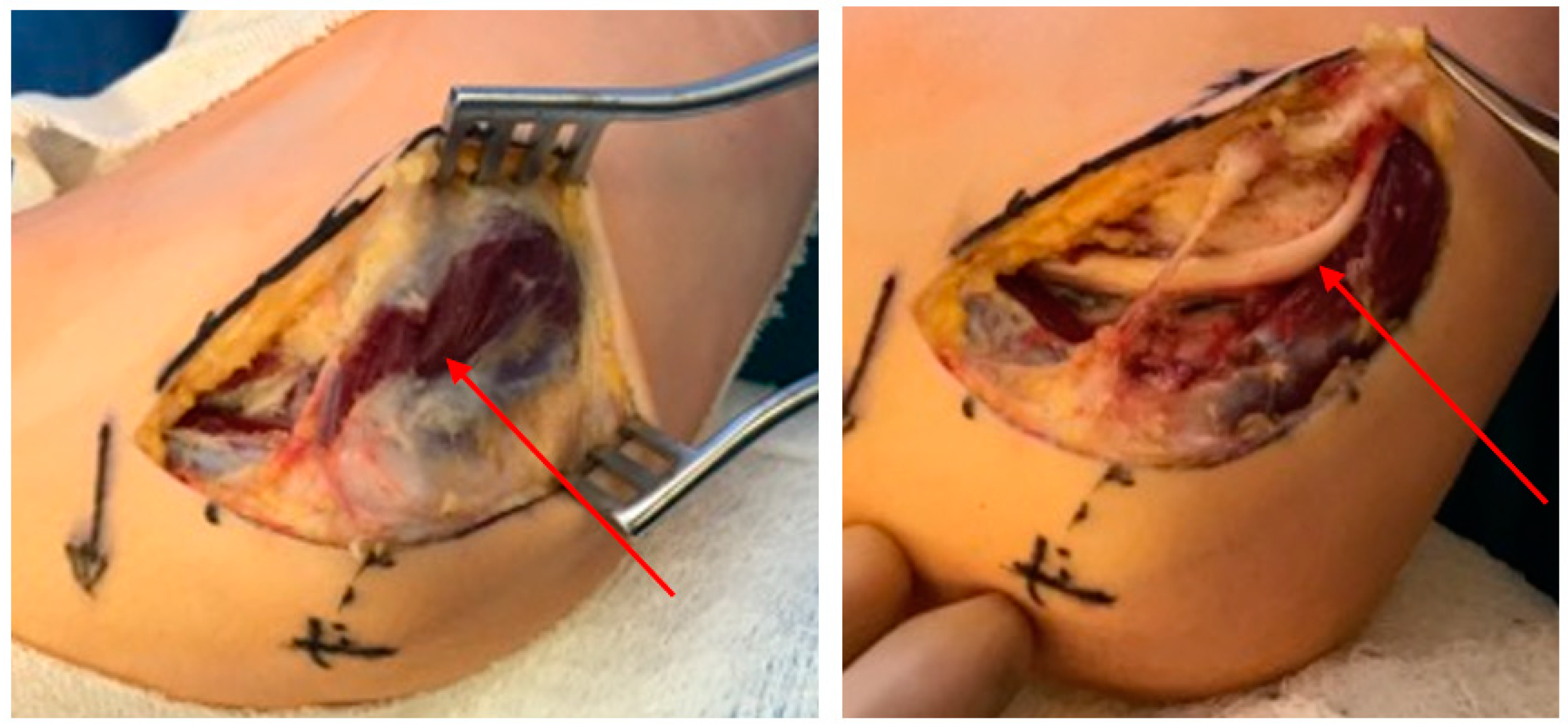 Surgeries 02 00032 g003