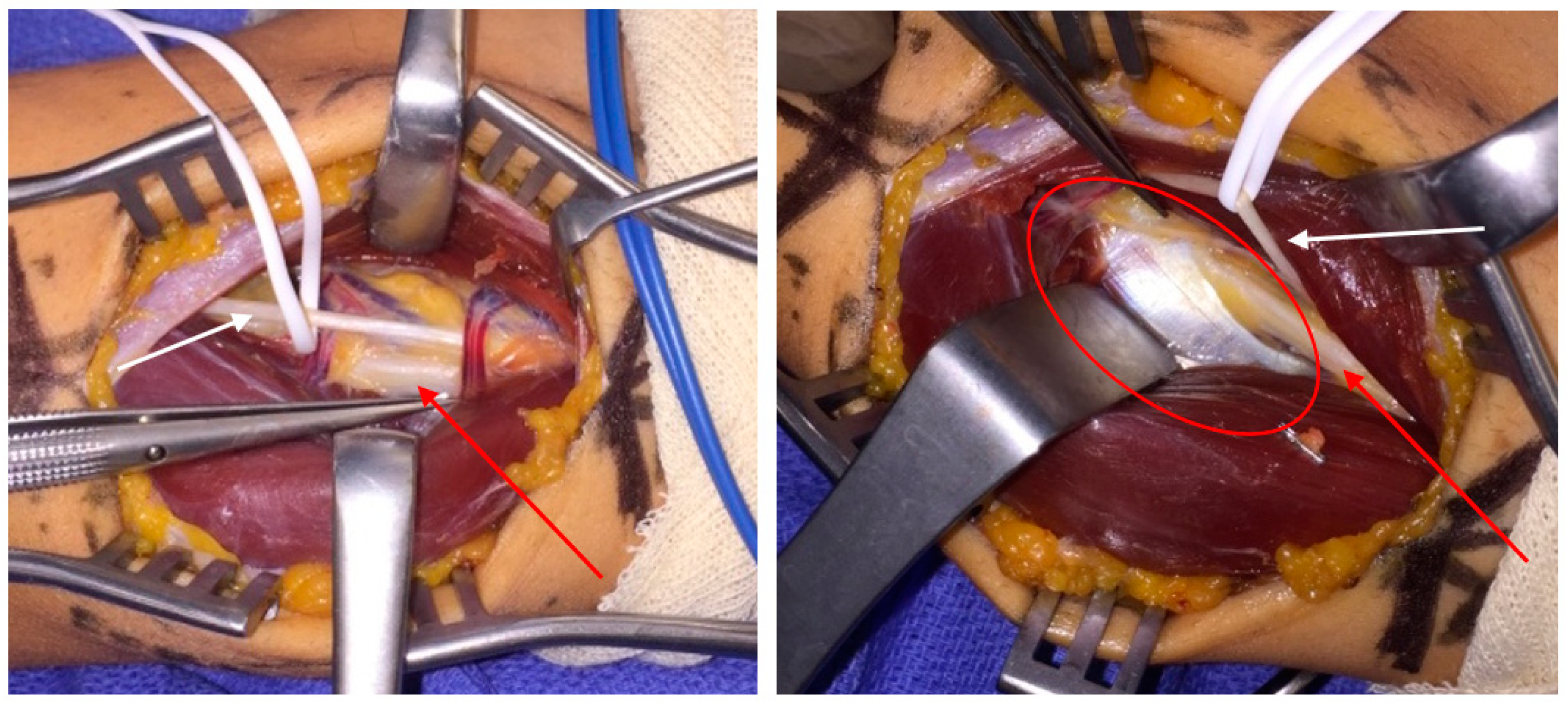Surgeries 02 00032 g004