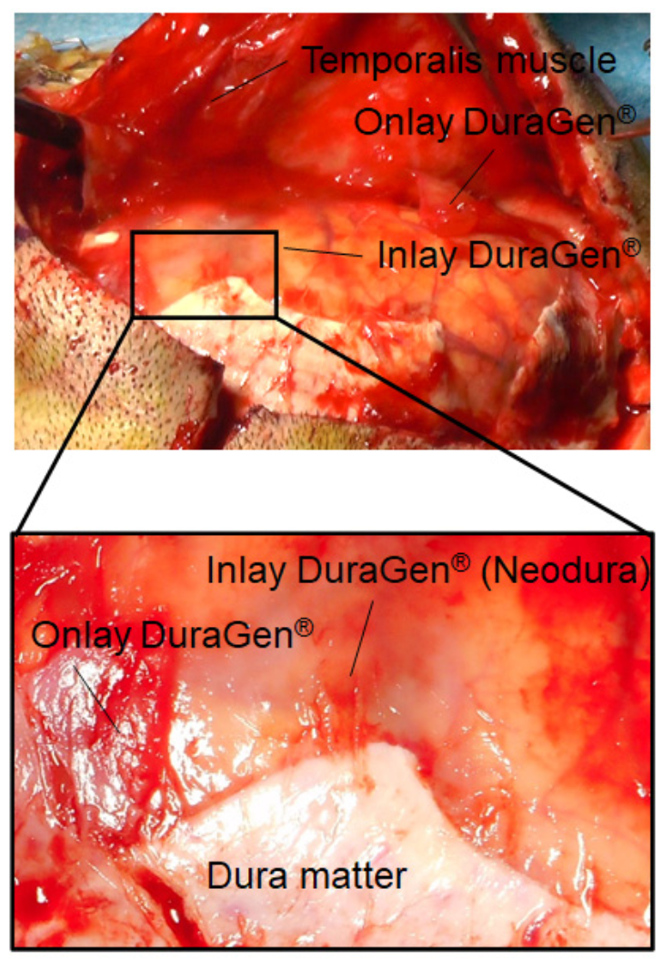 Surgeries 02 00036 g002