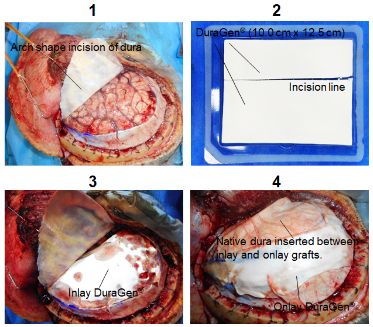 Surgeries 02 00036 g0a1