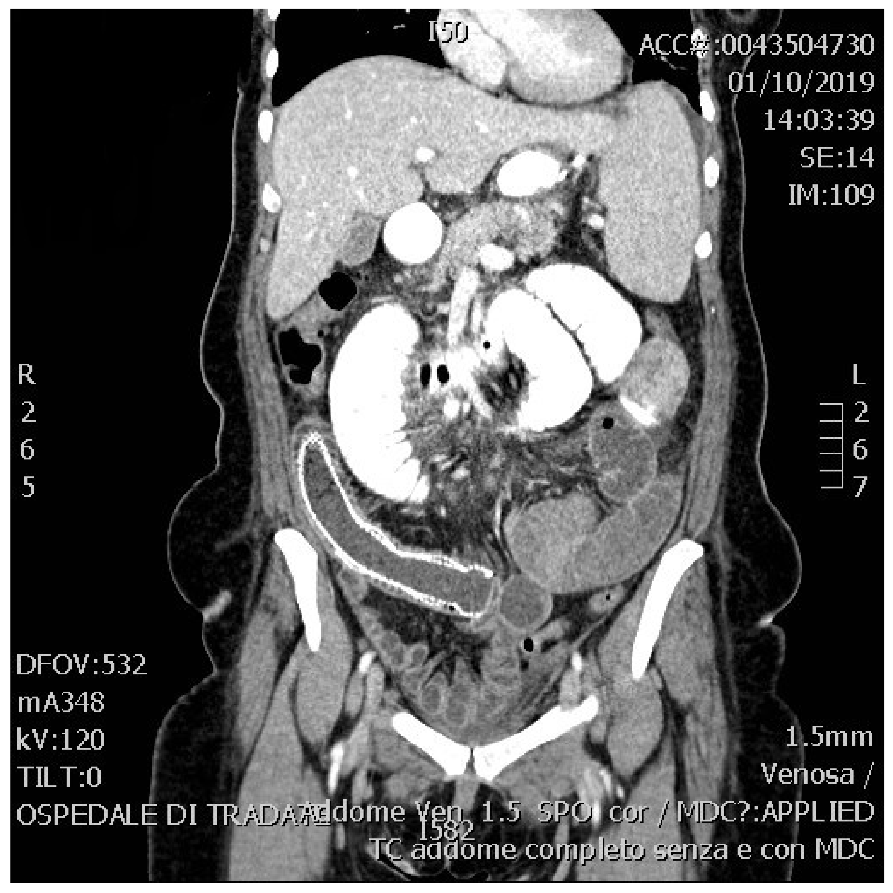 Surgeries 02 00037 g001