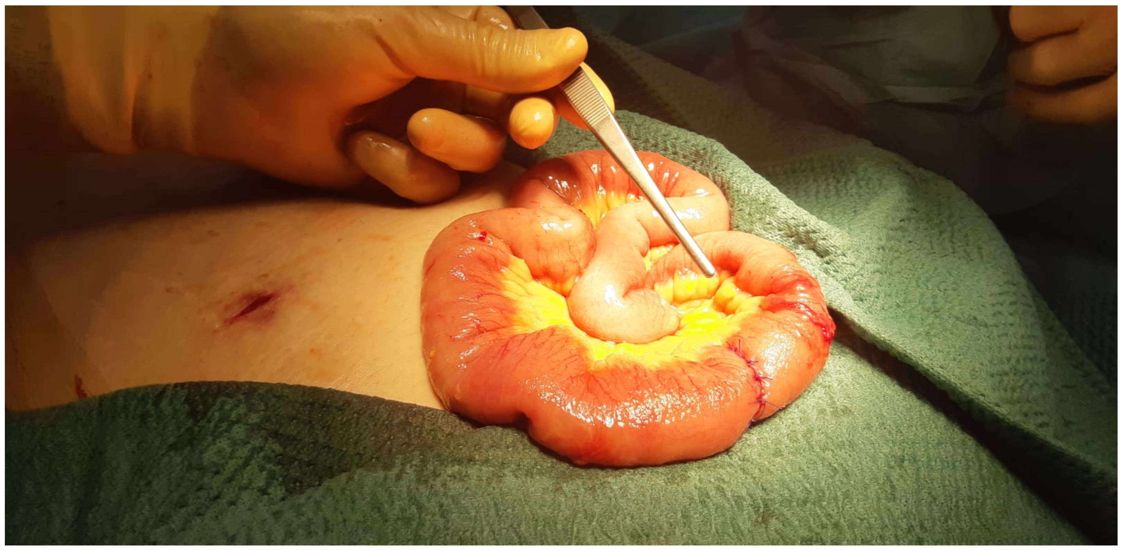 Surgeries 02 00037 g004