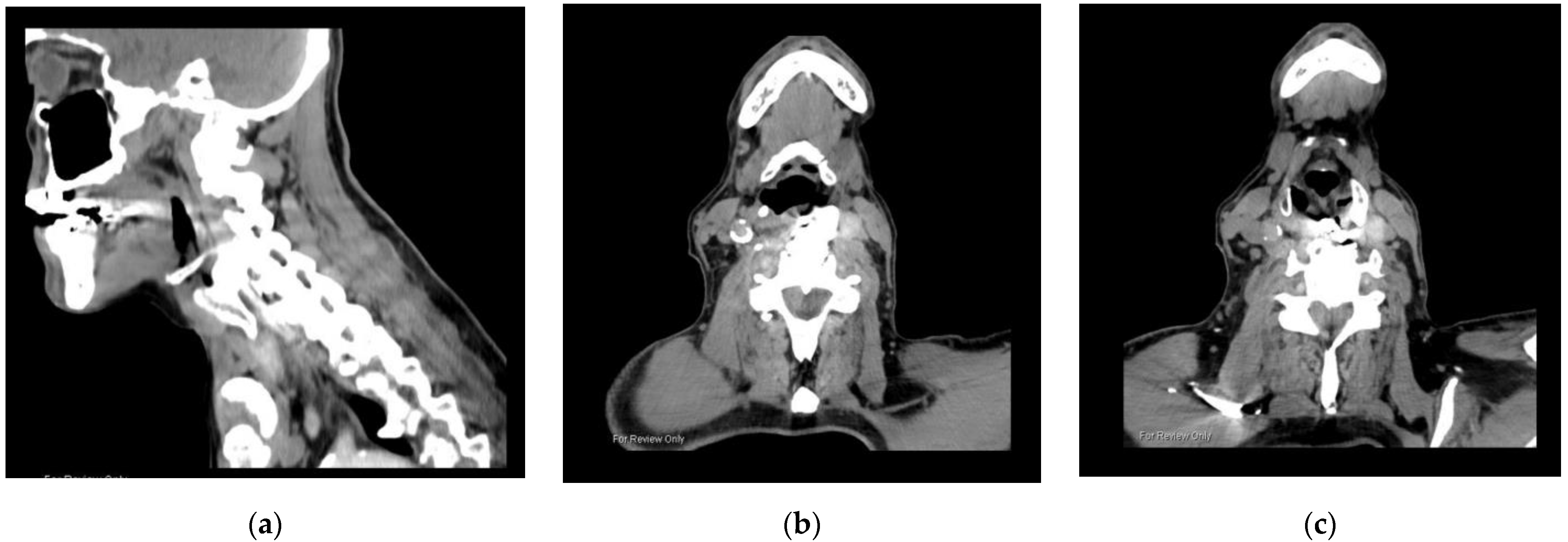 Surgeries 02 00038 g003