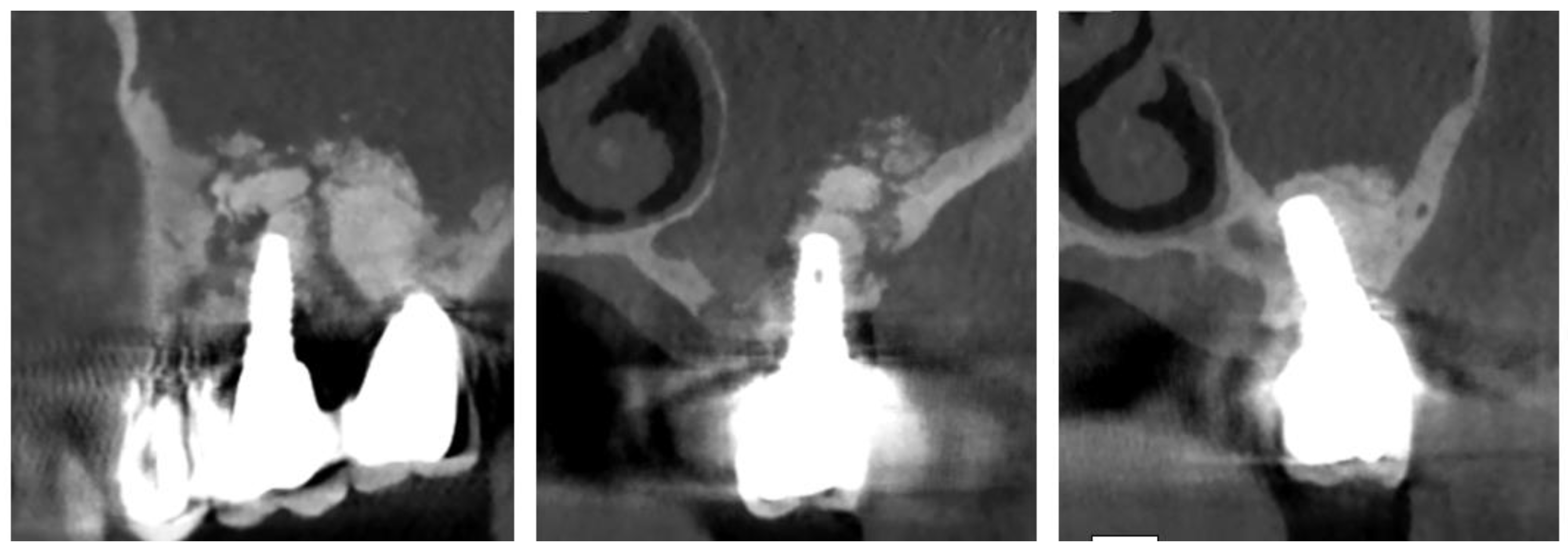 Surgeries 02 00040 g001