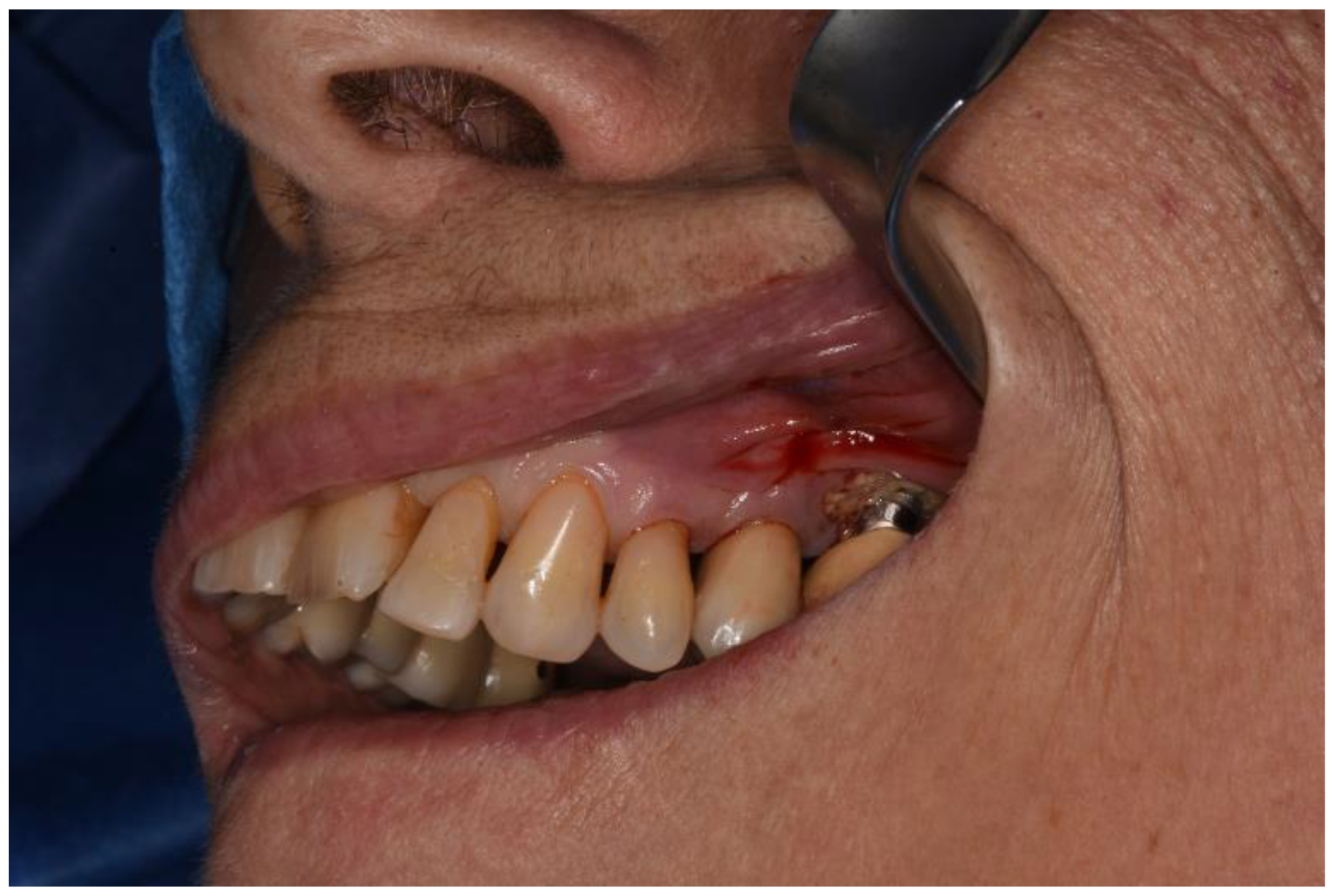 Surgeries 02 00040 g002