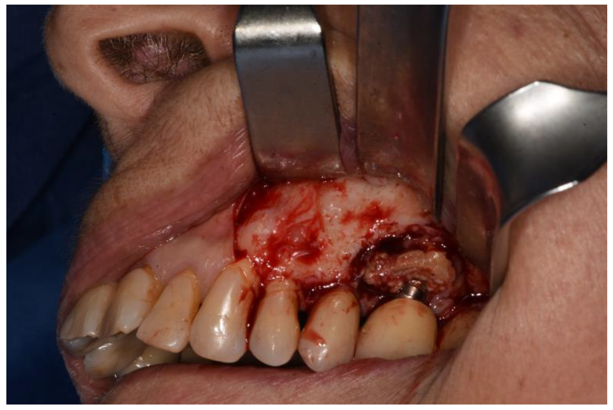 Surgeries 02 00040 g003