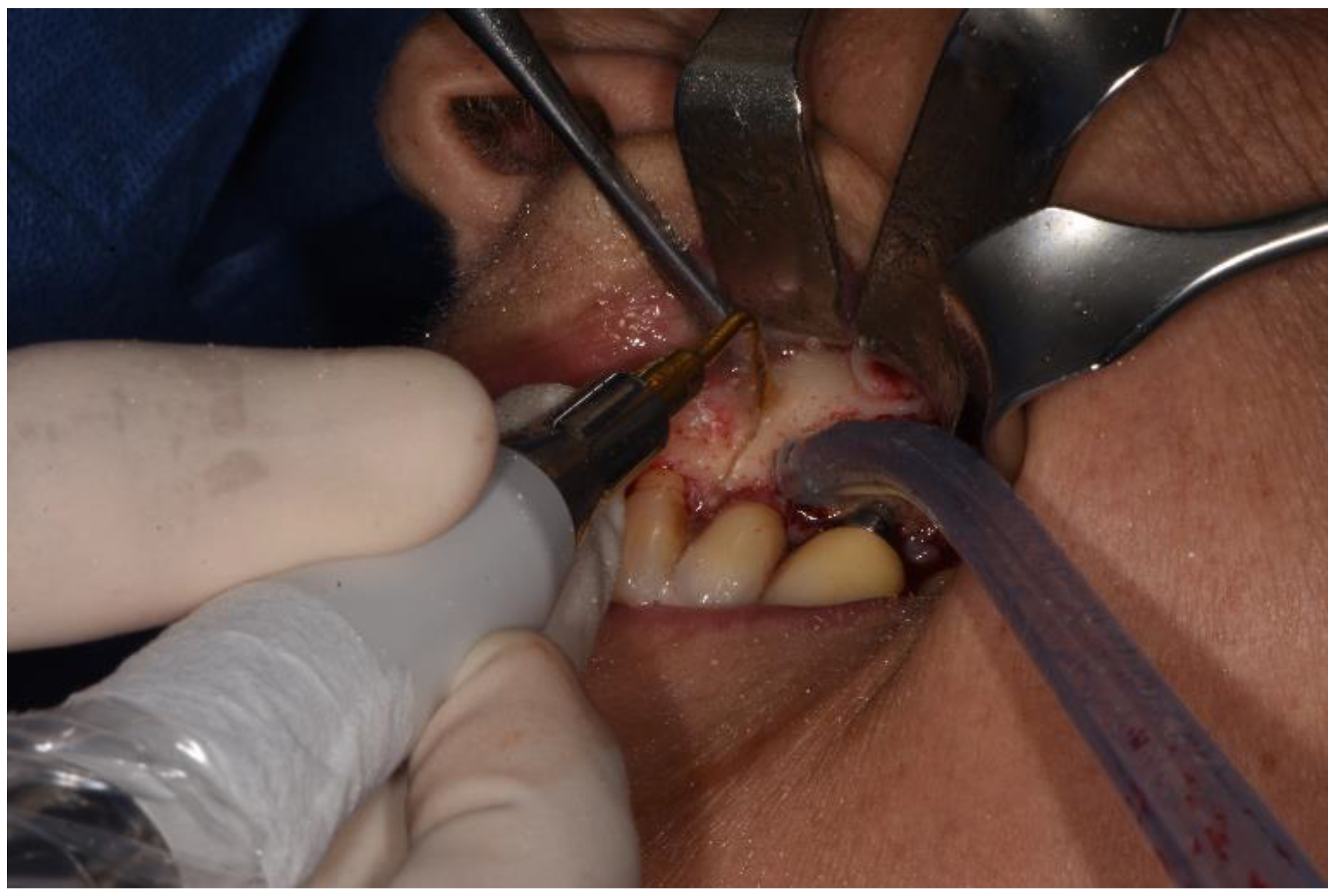 Surgeries 02 00040 g004