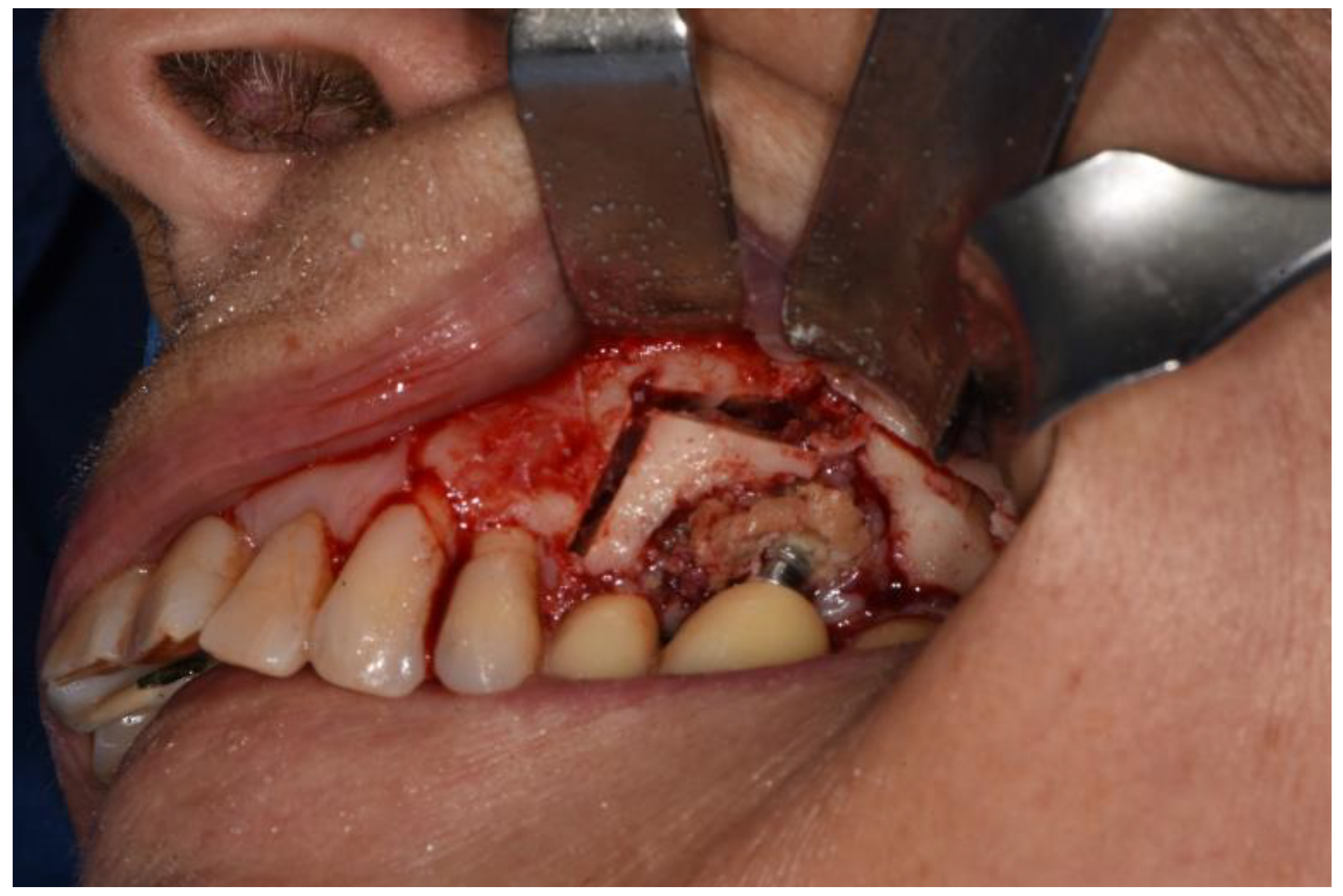 Surgeries 02 00040 g005