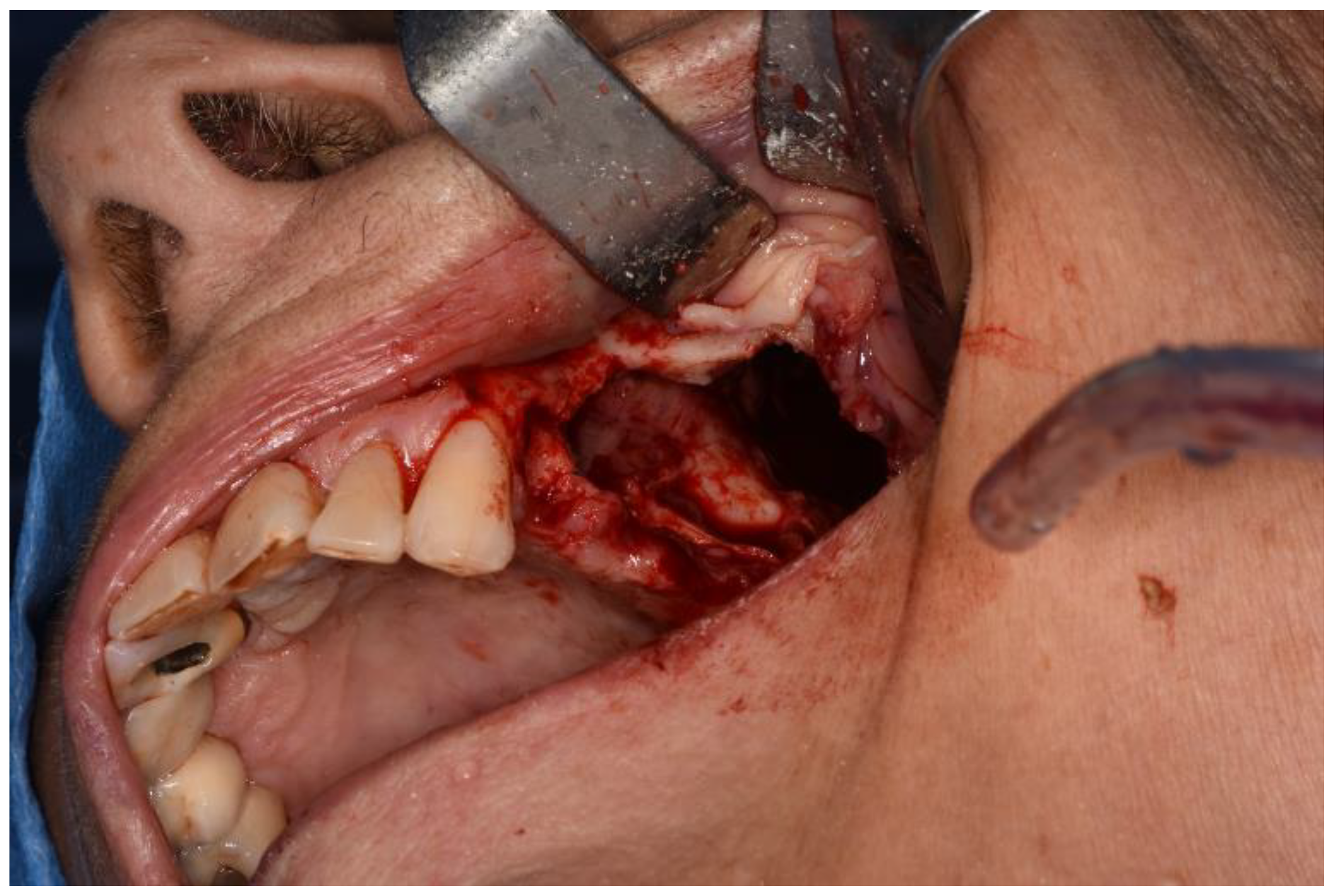 Surgeries 02 00040 g006