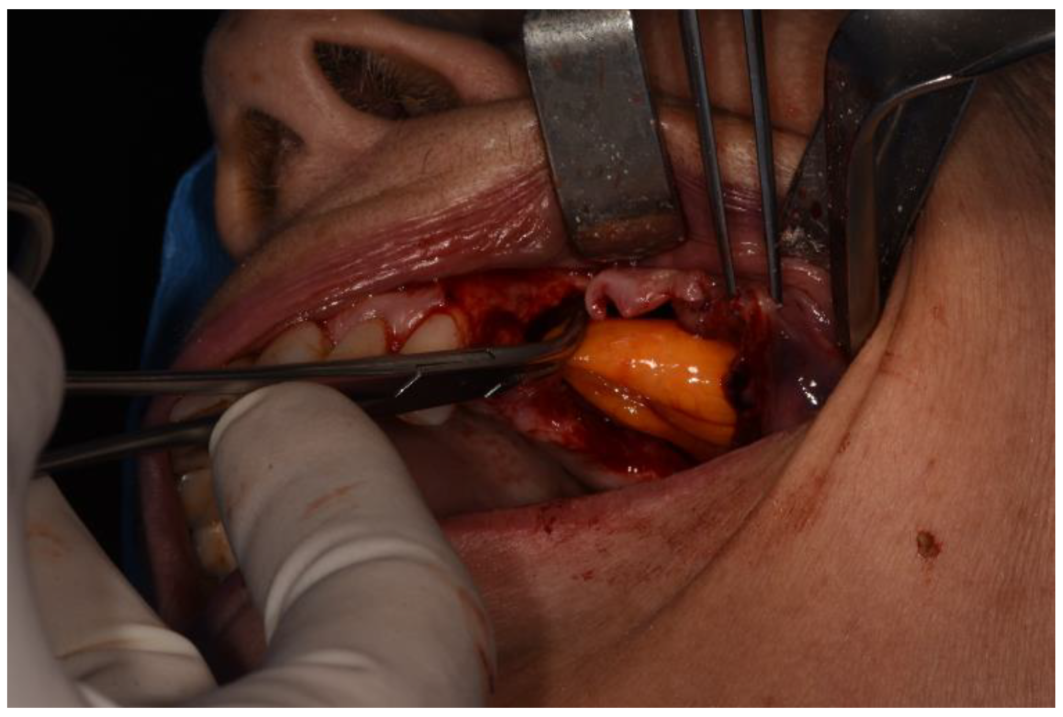 Surgeries 02 00040 g008