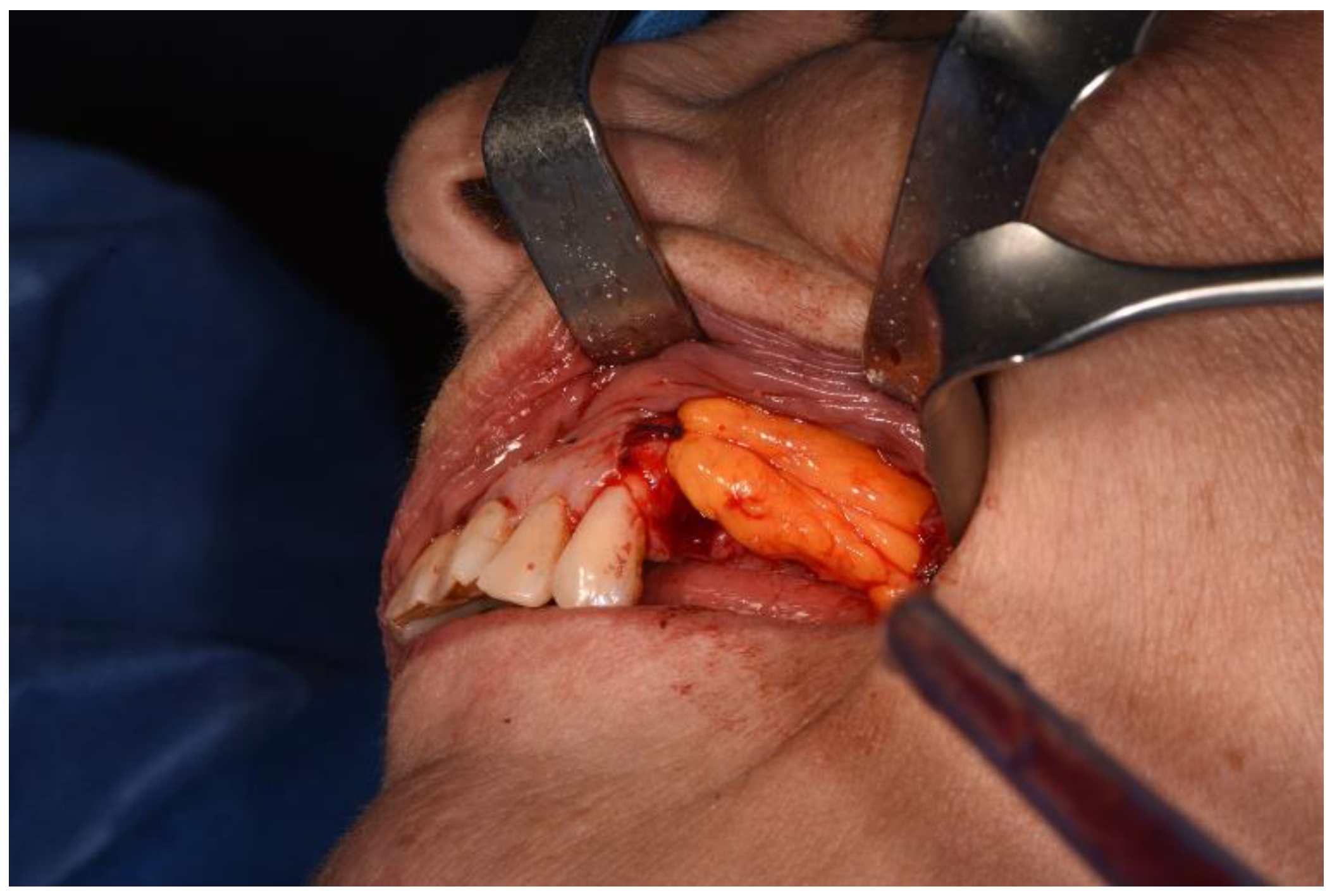 Surgeries 02 00040 g009