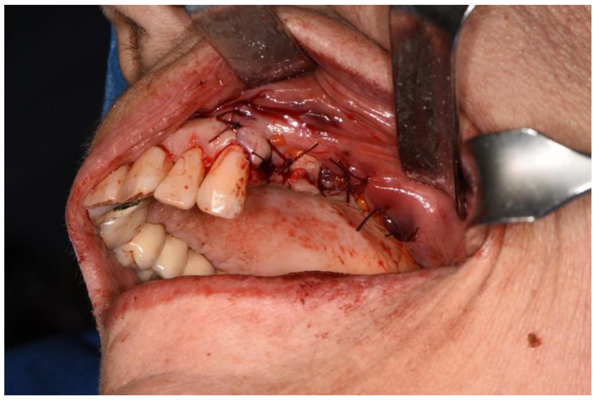 Surgeries 02 00040 g010