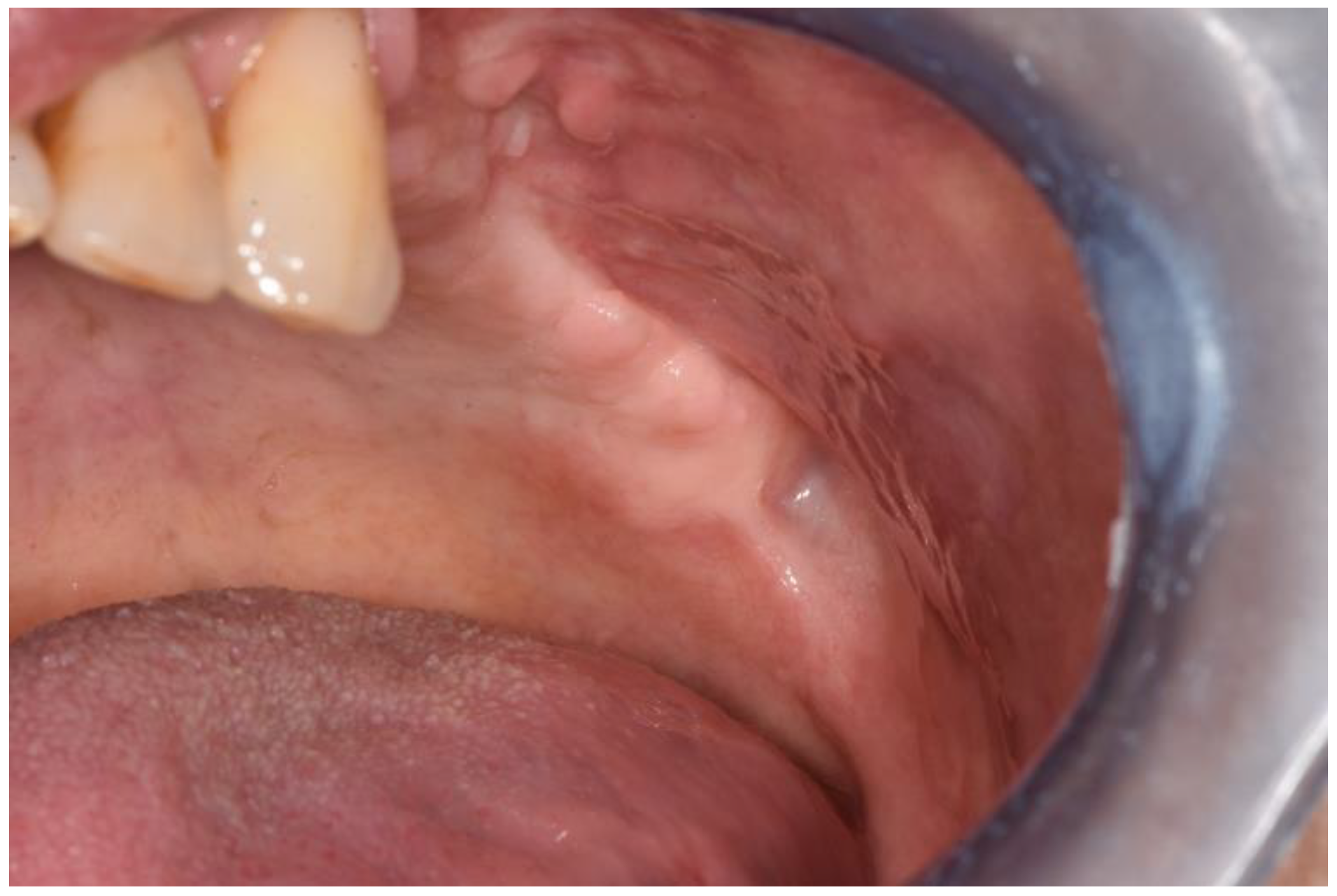 Surgeries 02 00040 g011