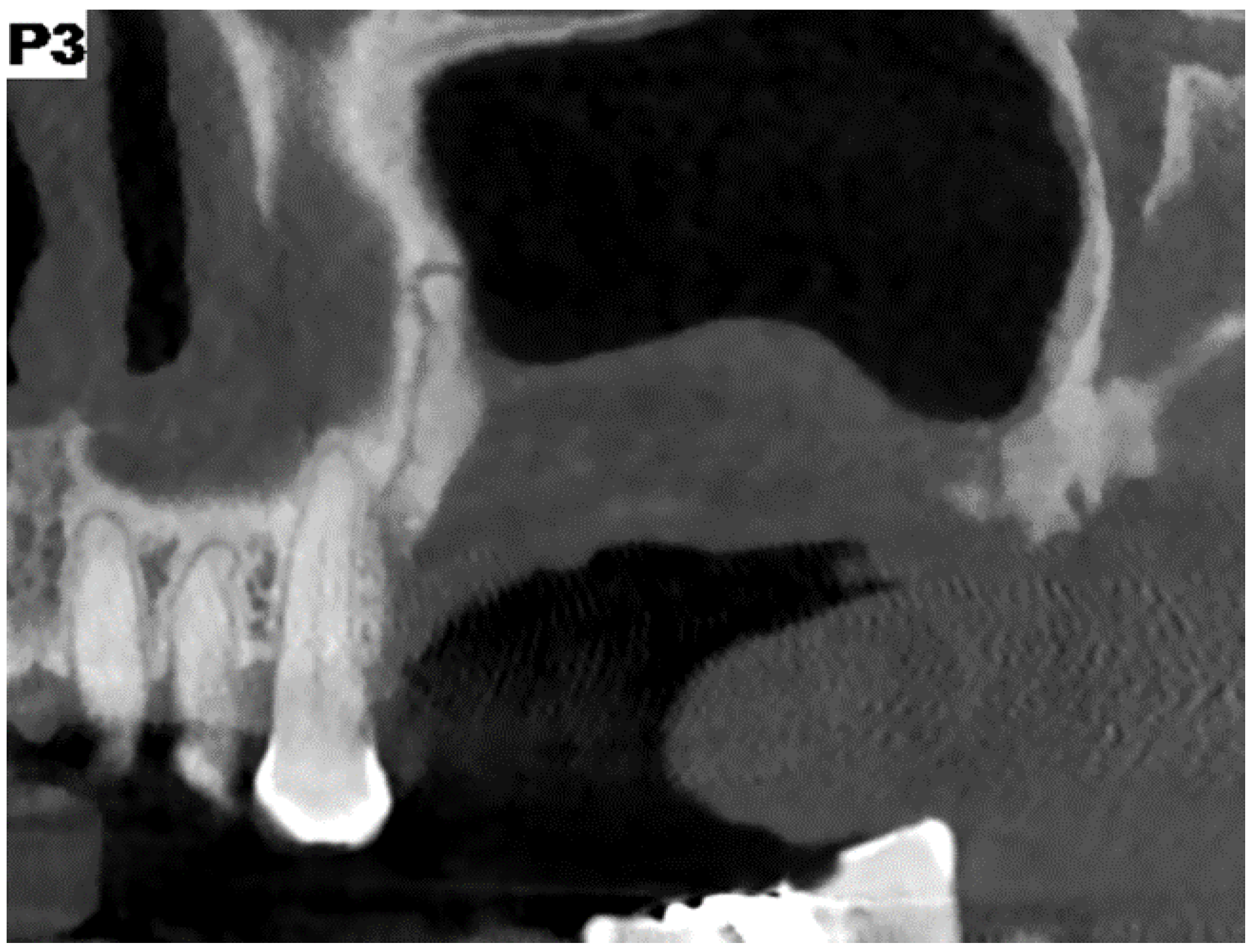 Surgeries 02 00040 g012