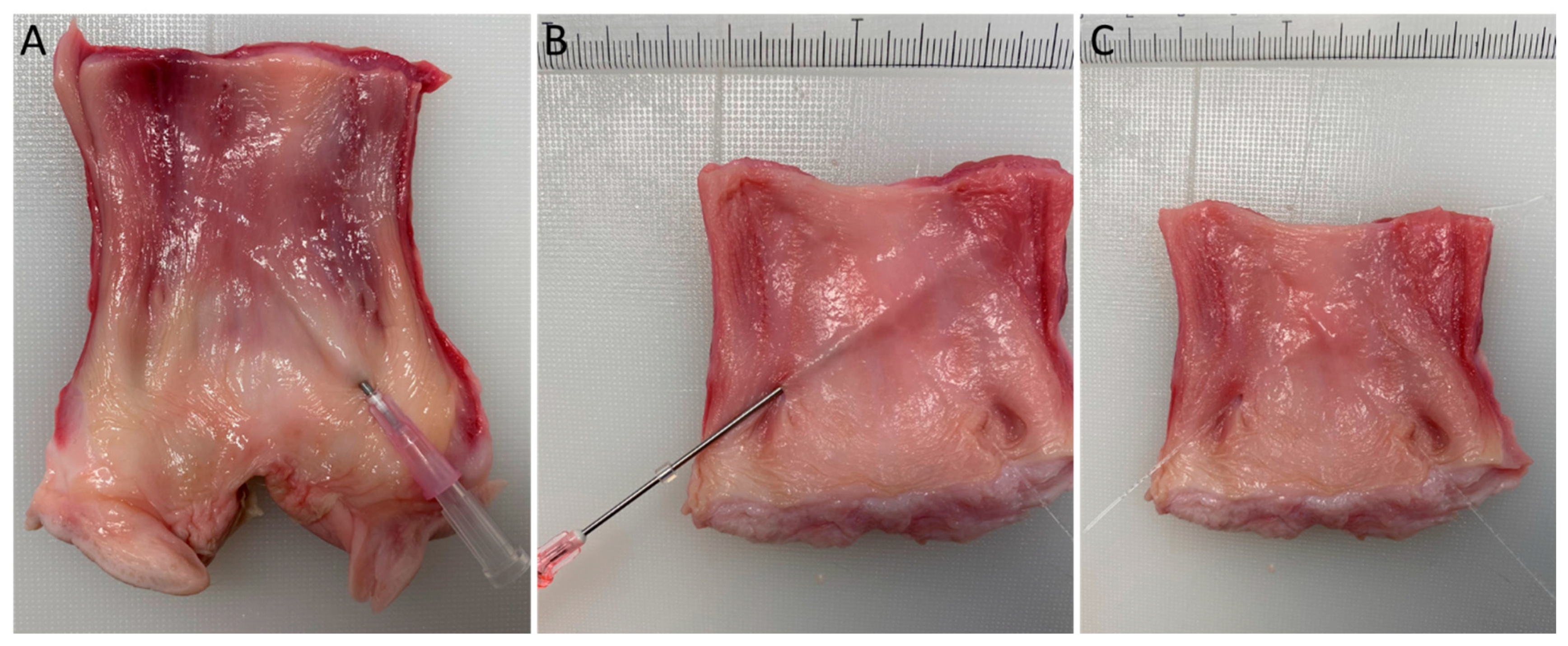 Surgeries 03 00012 g003