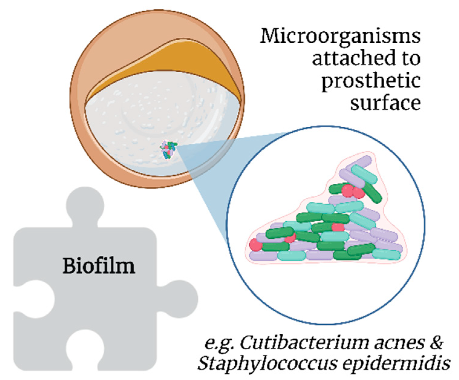 Surgeries 03 00013 g004