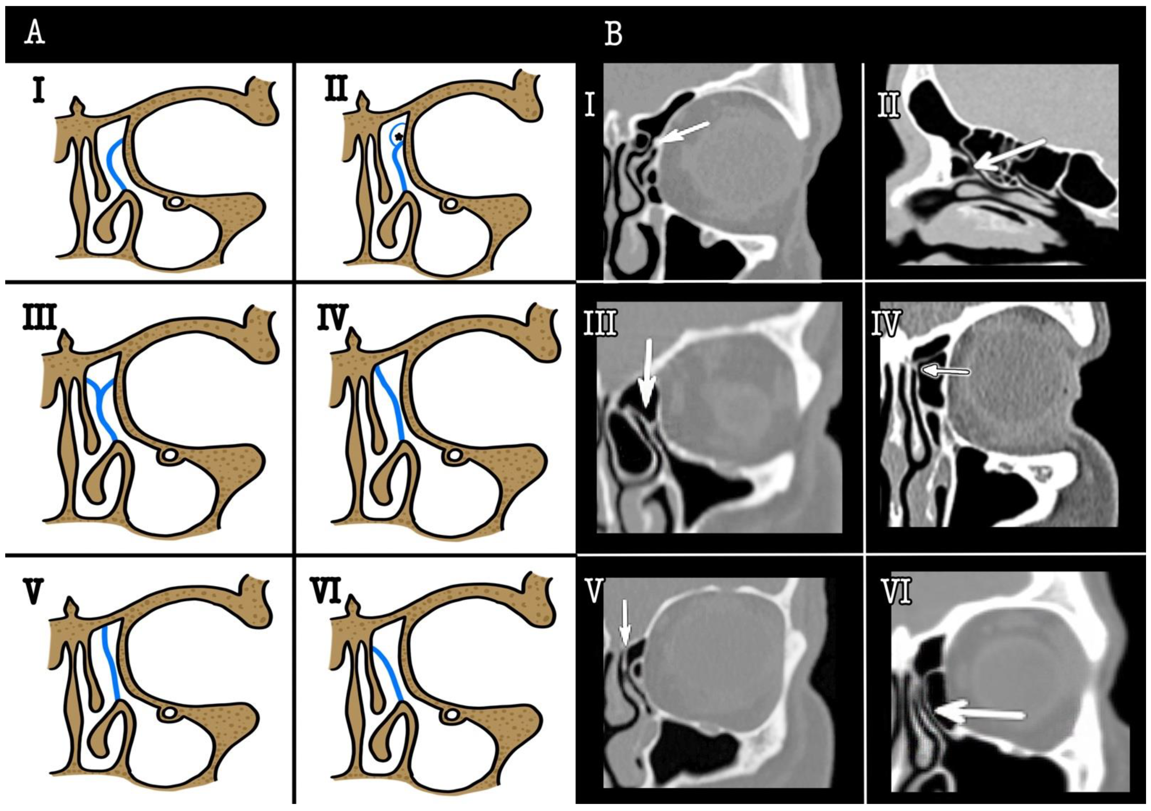 Surgeries 03 00015 g001