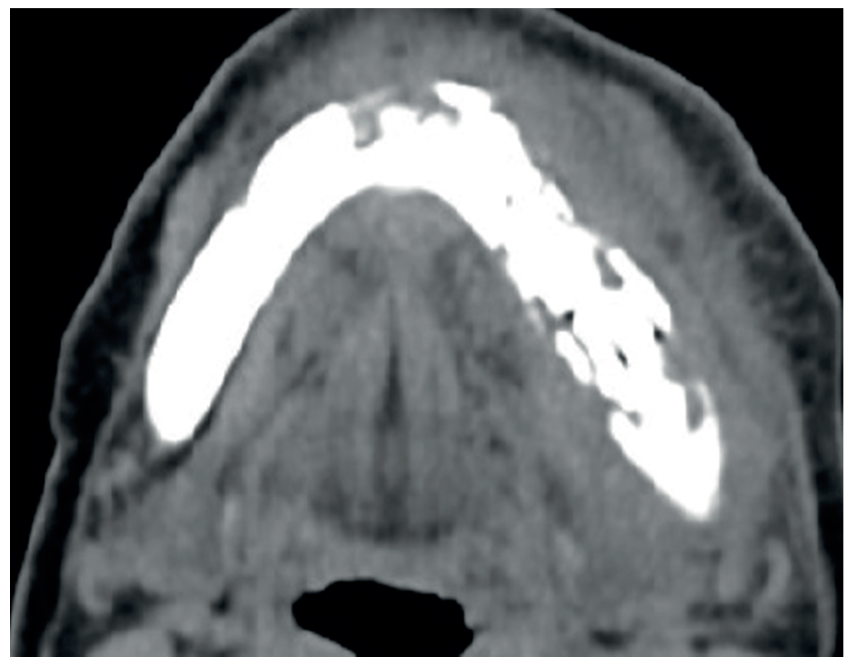 Surgeries 03 00016 g003