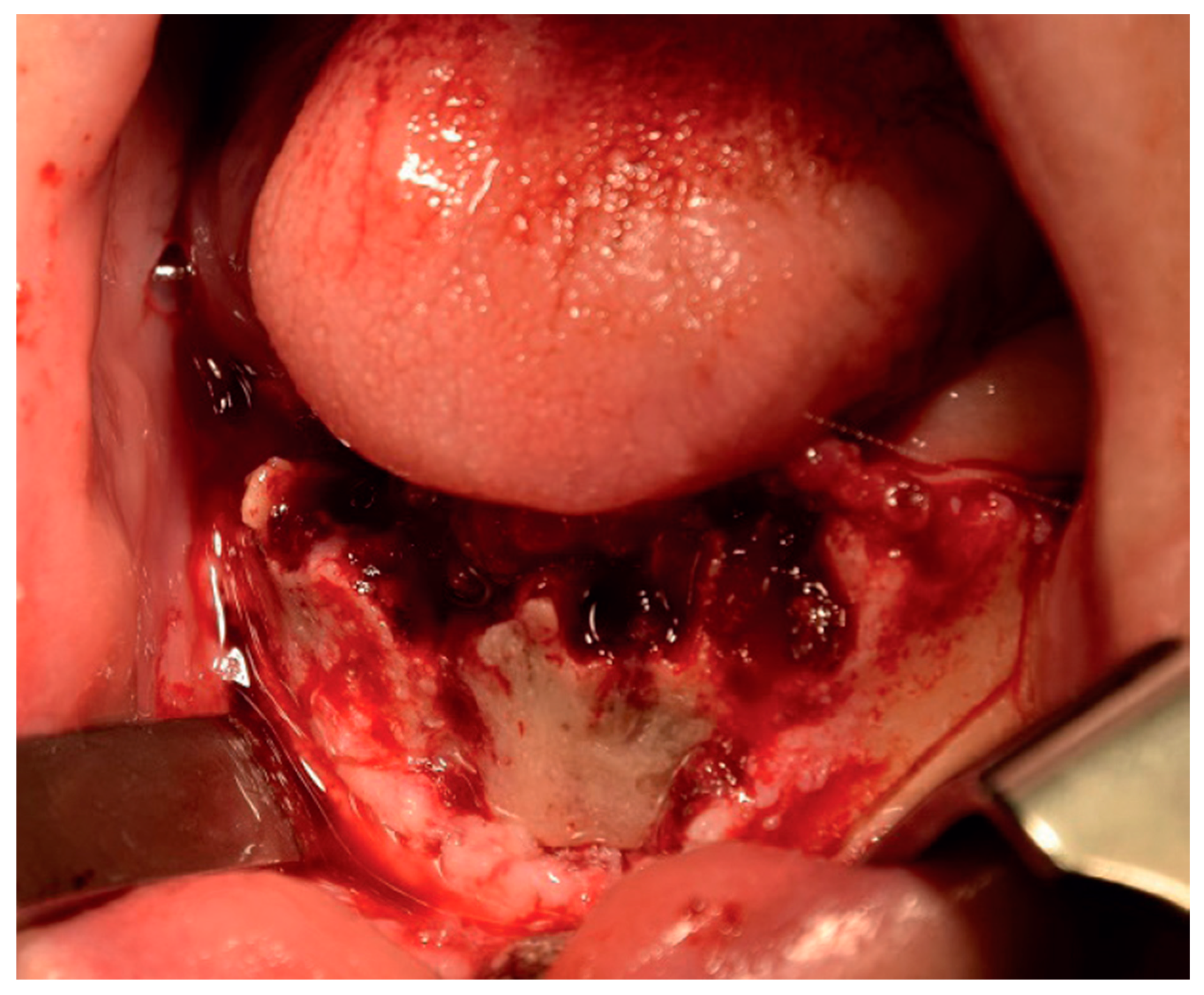 Surgeries 03 00016 g004