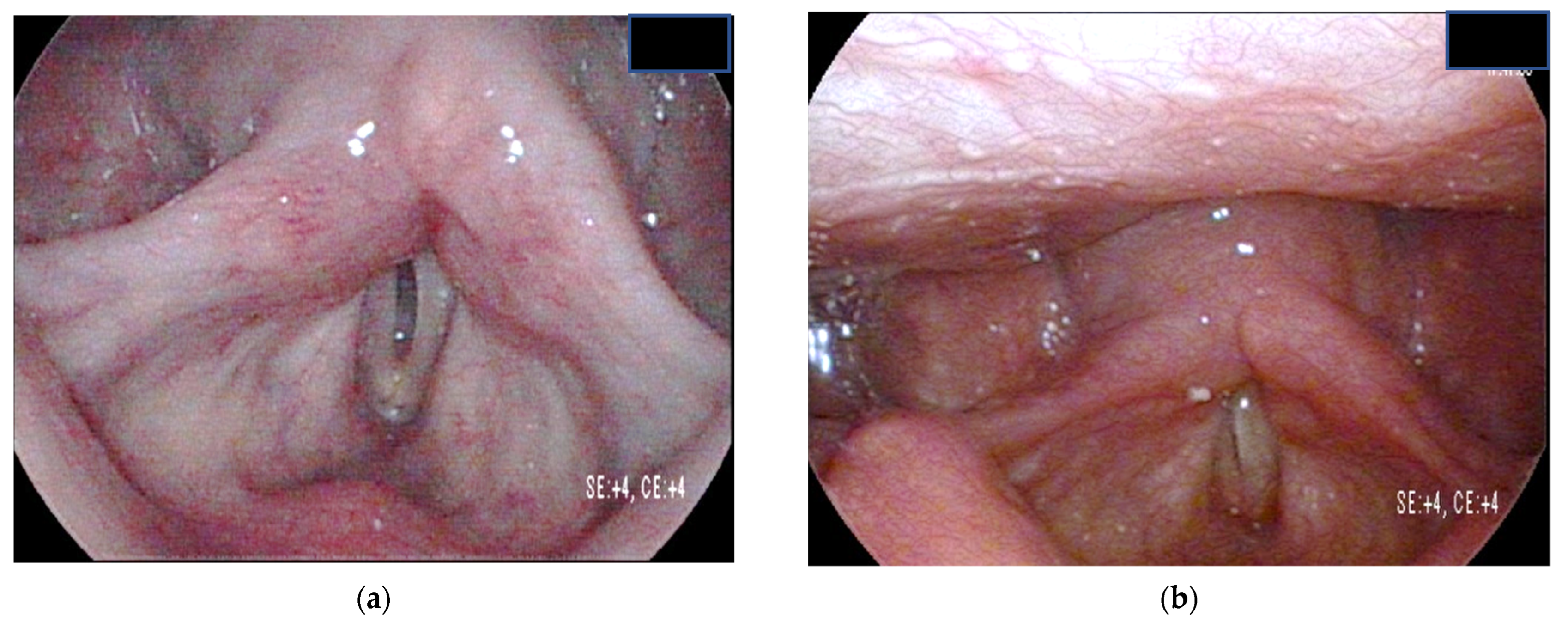 Surgeries 03 00023 g003