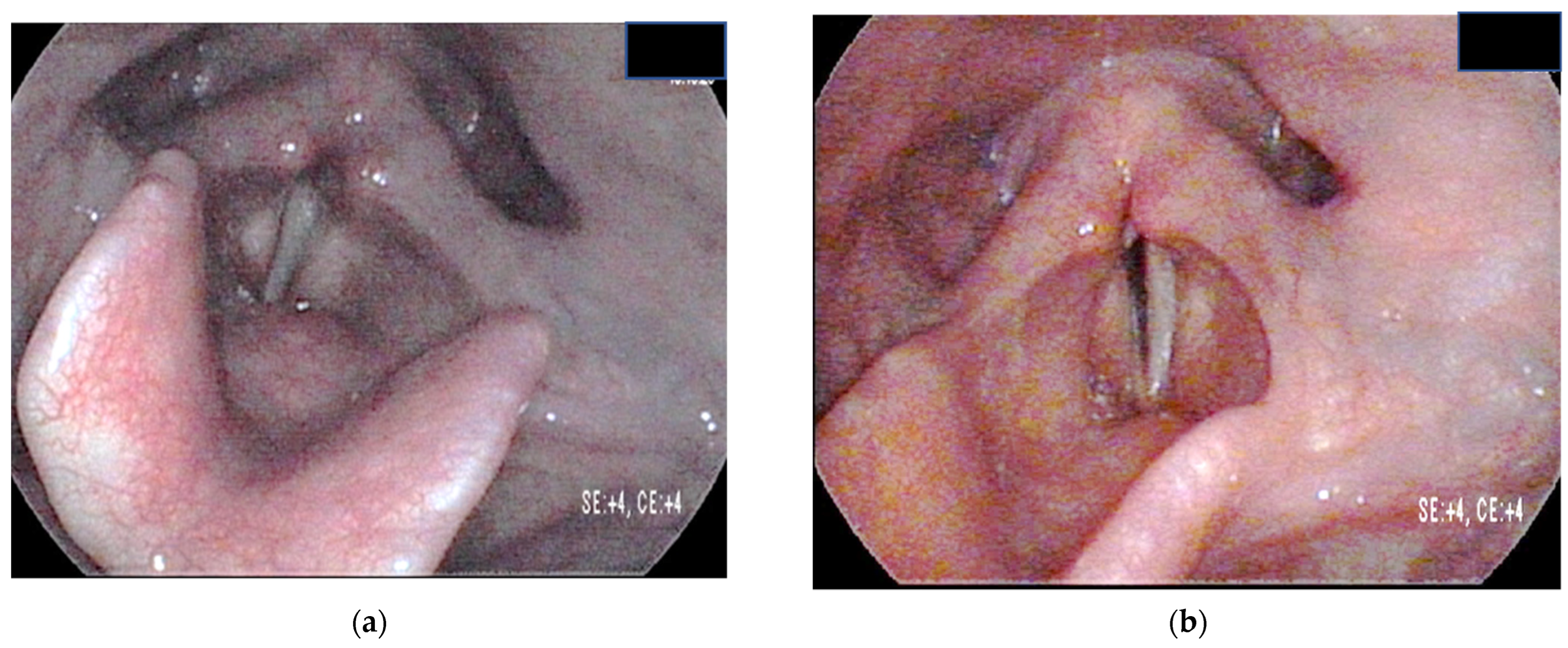 Surgeries 03 00023 g004