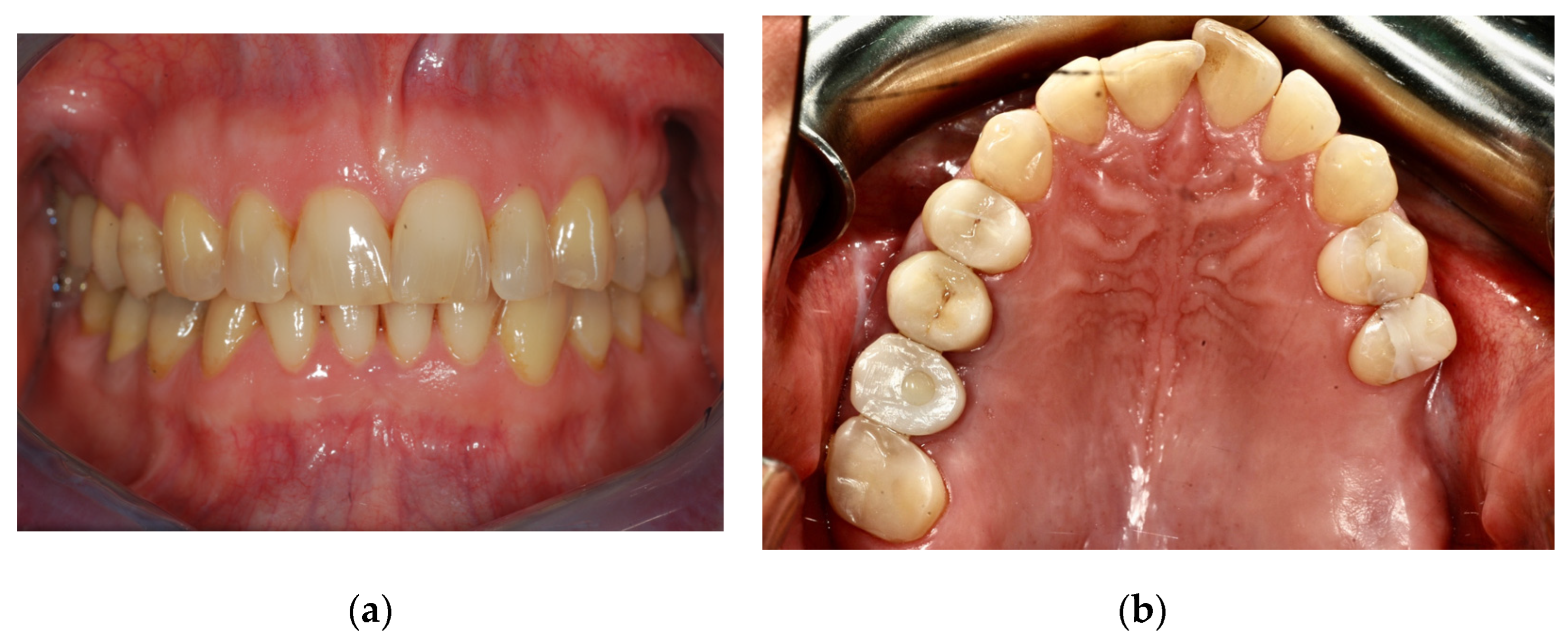 Surgeries 03 00032 g001