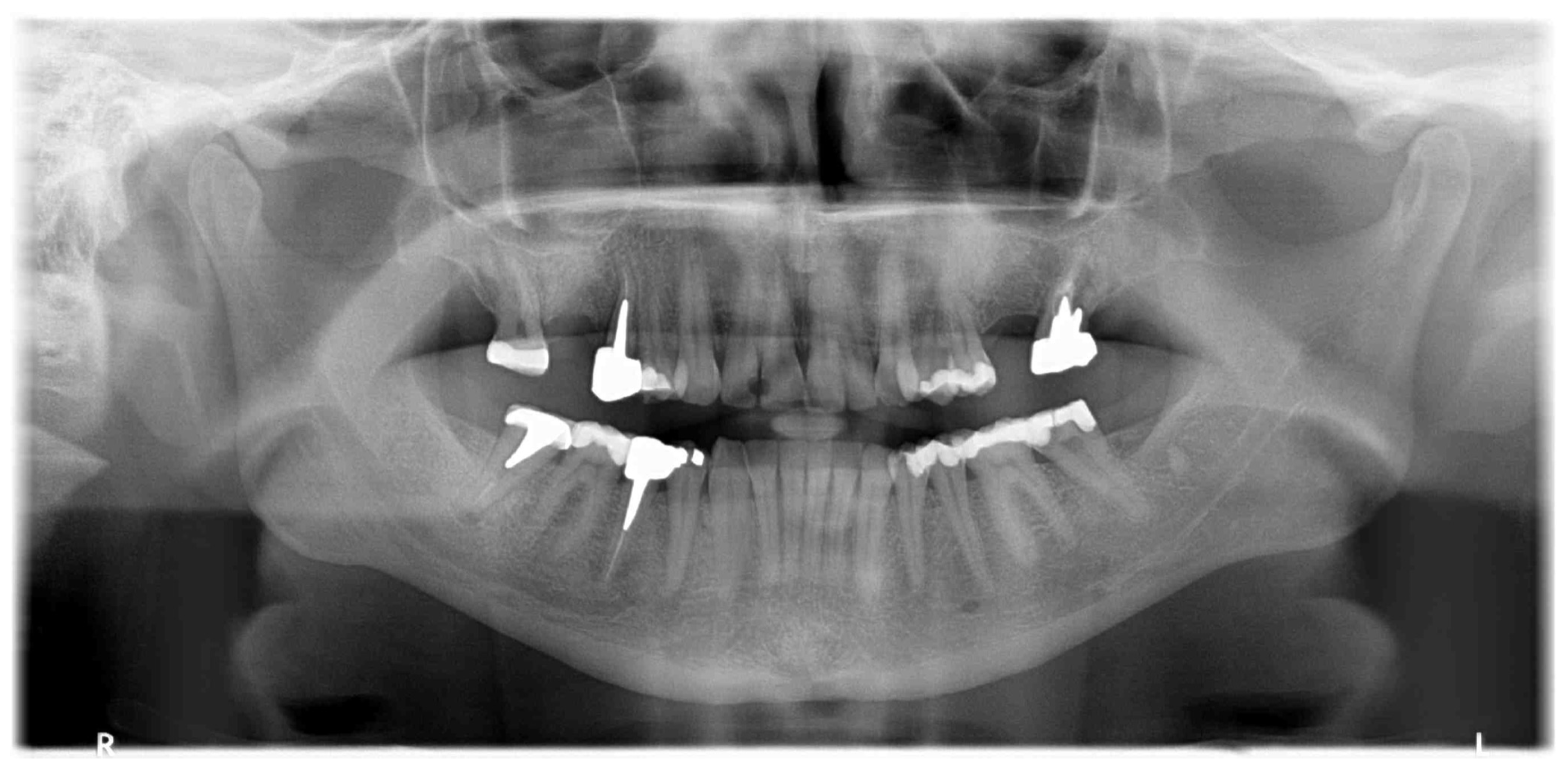 Surgeries 03 00032 g002