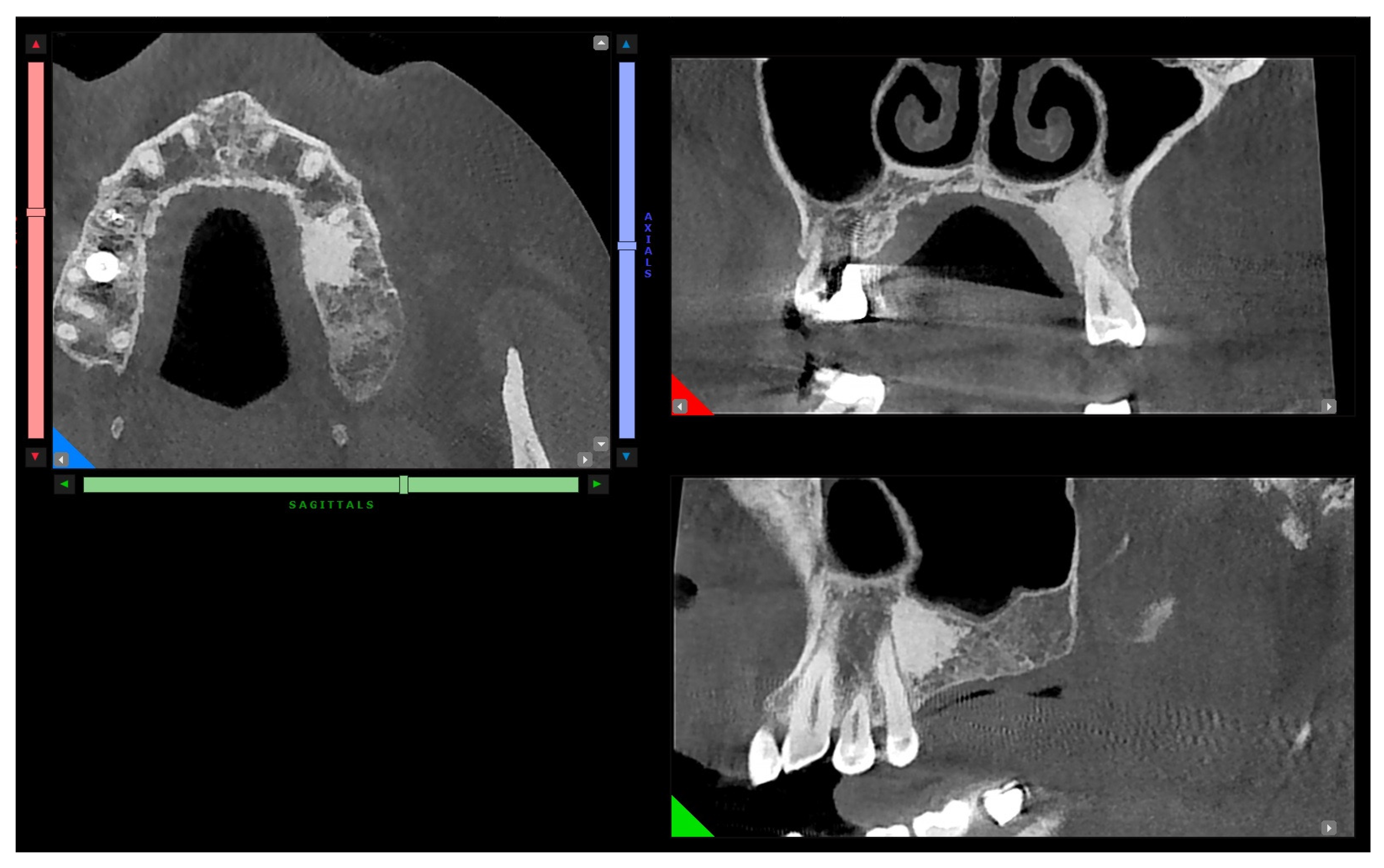 Surgeries 03 00032 g003
