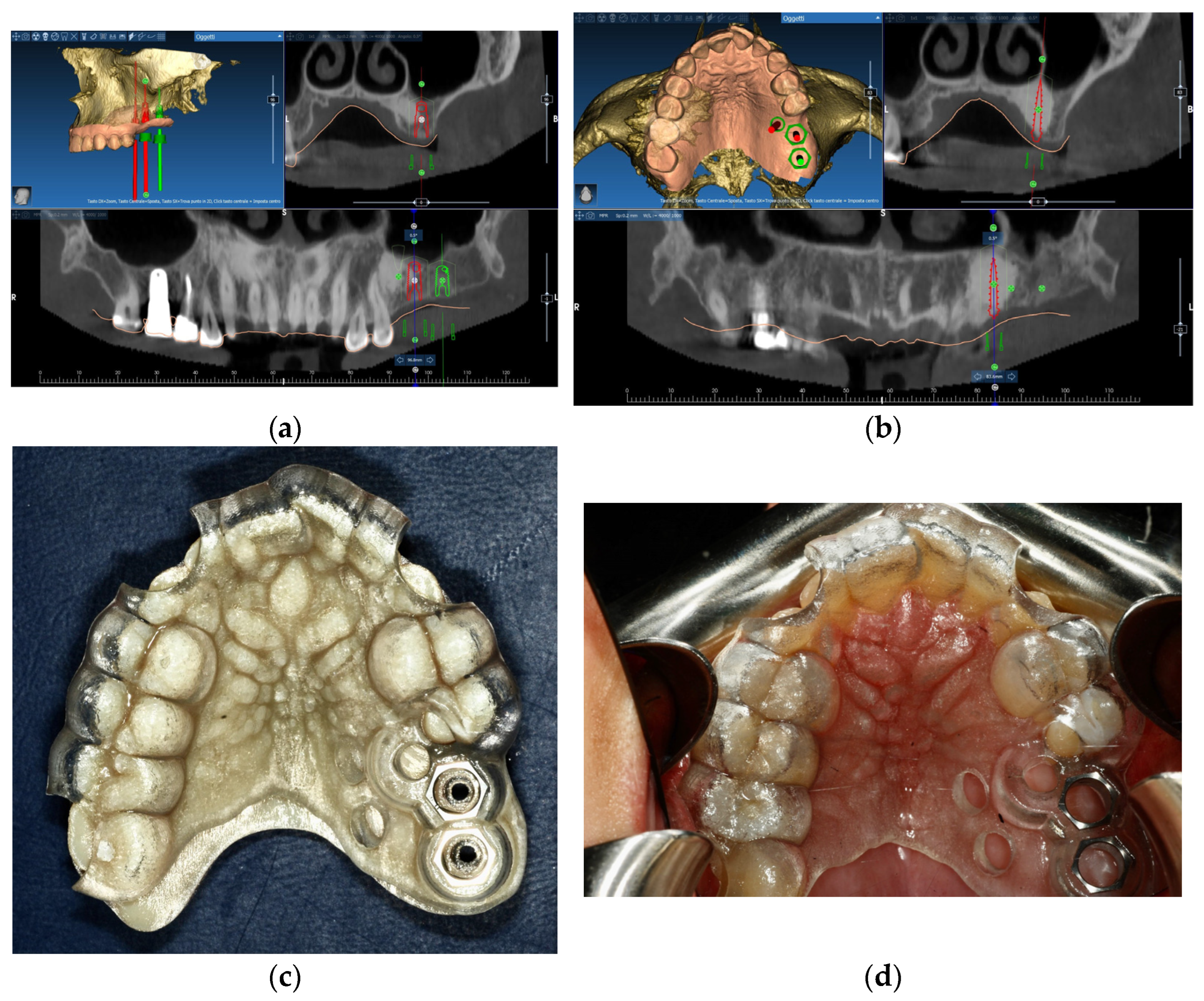 Surgeries 03 00032 g004