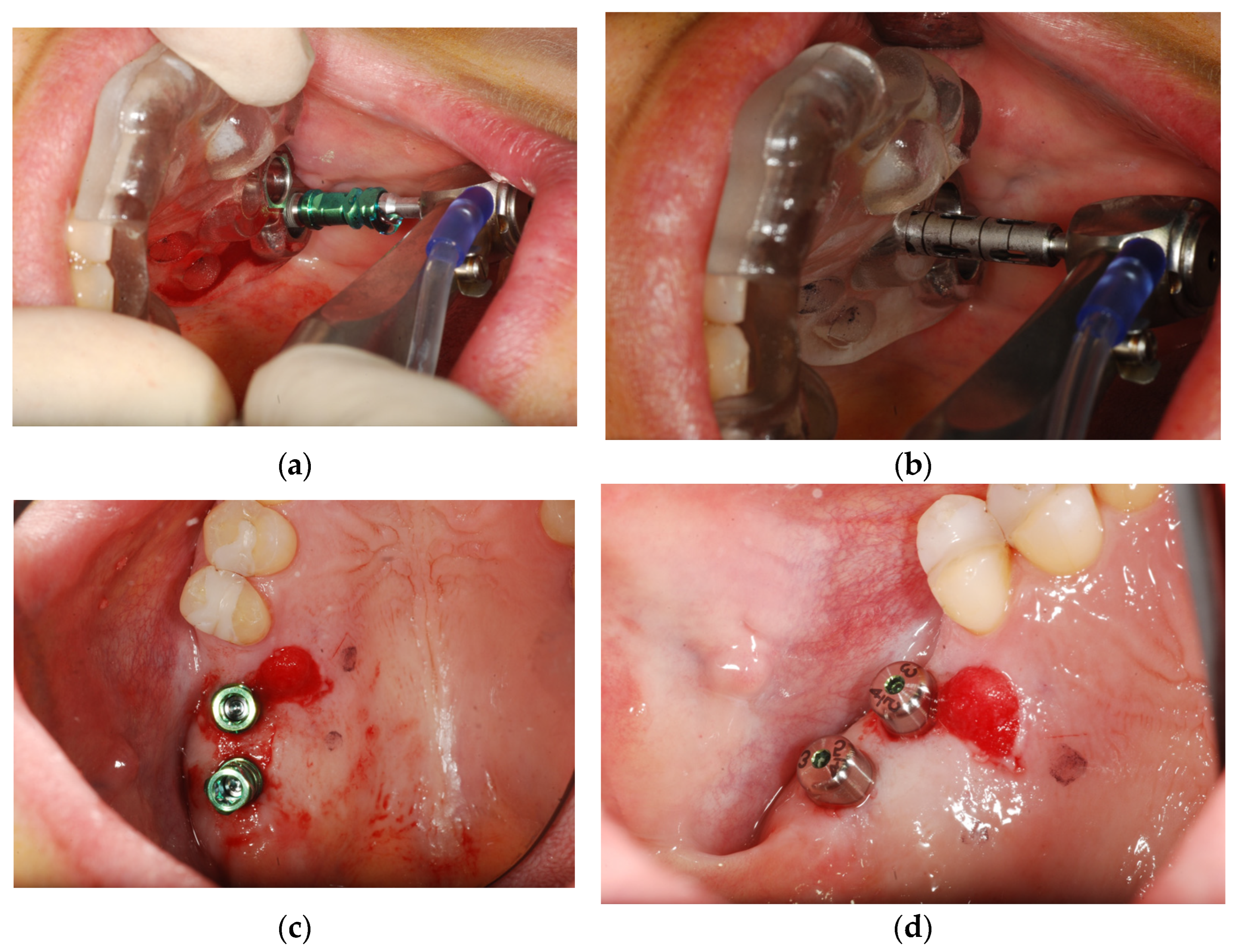 Surgeries 03 00032 g005