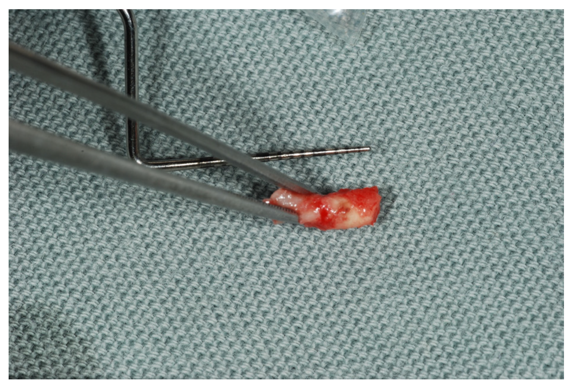 Surgeries 03 00032 g006