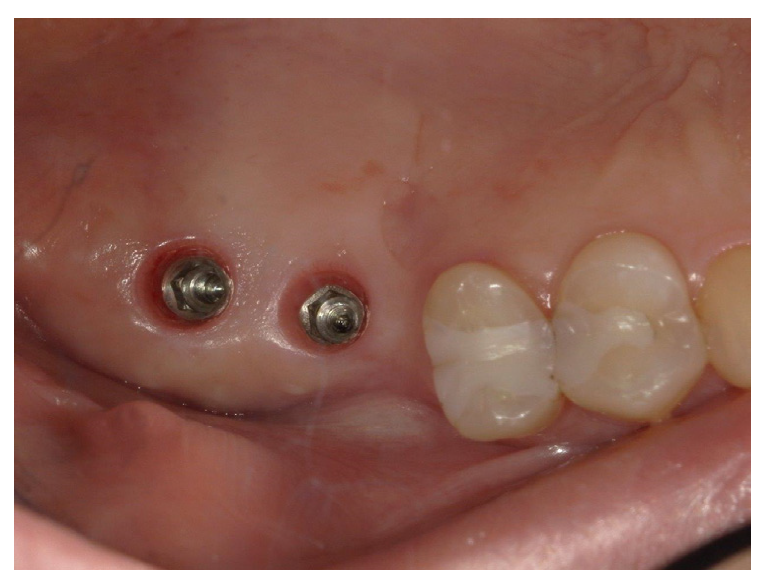 Surgeries 03 00032 g008