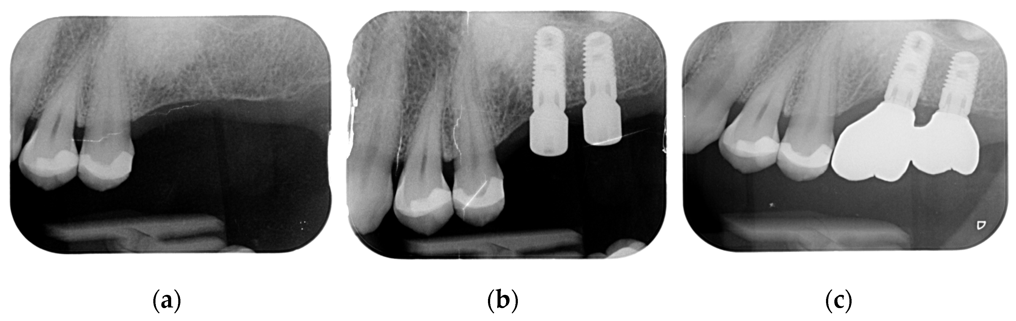 Surgeries 03 00032 g009