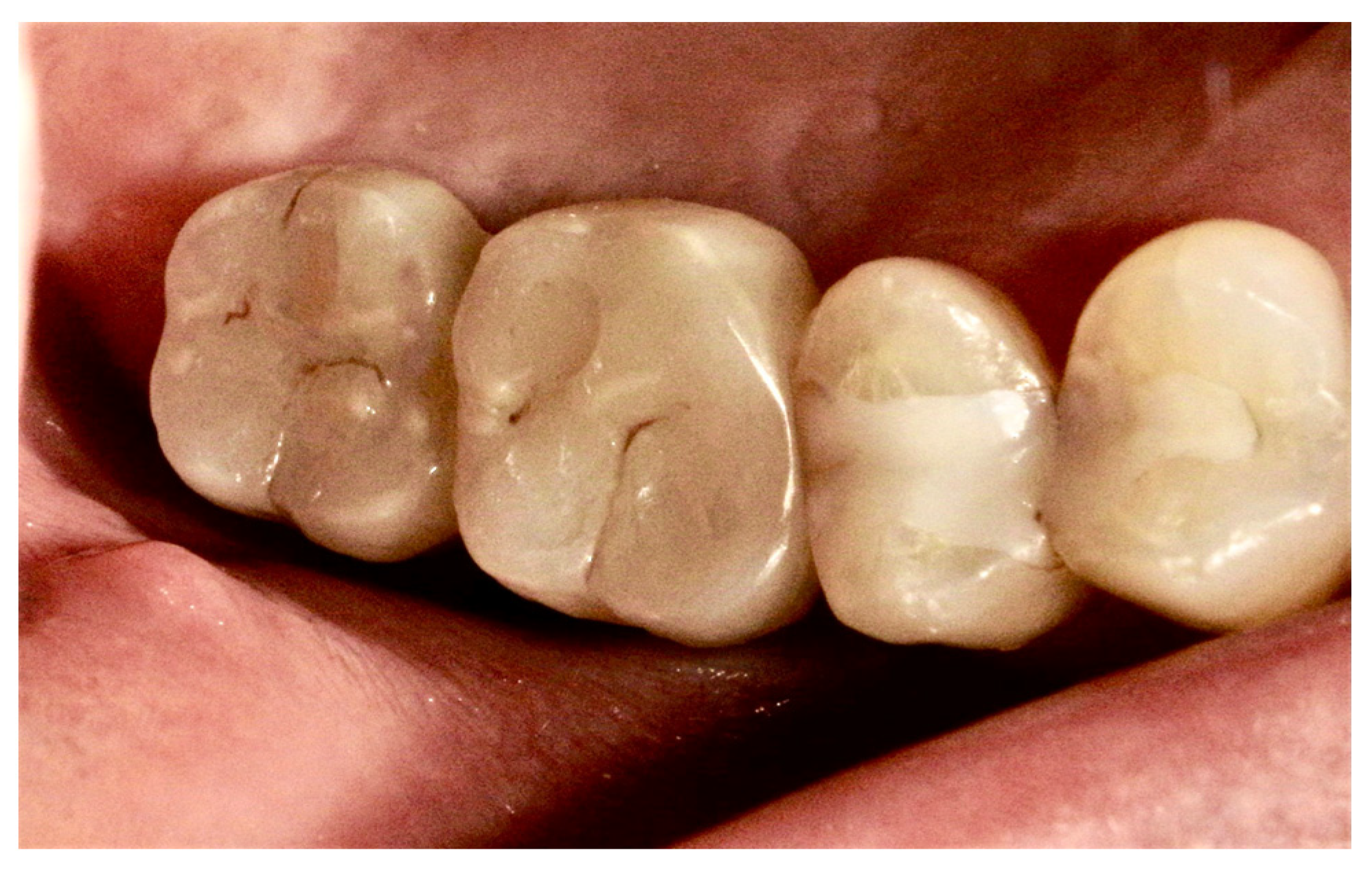 Surgeries 03 00032 g010