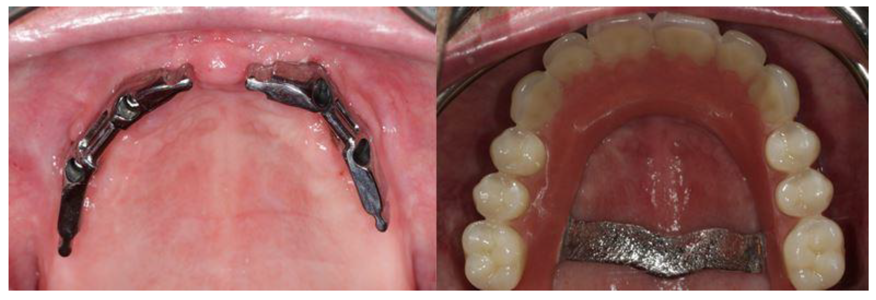 Surgeries 03 00033 g006
