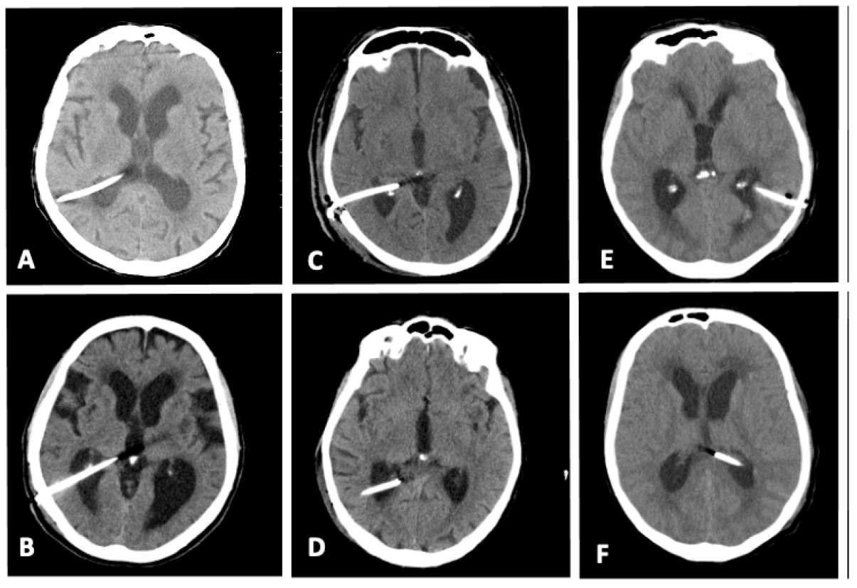 Surgeries 03 00034 g002