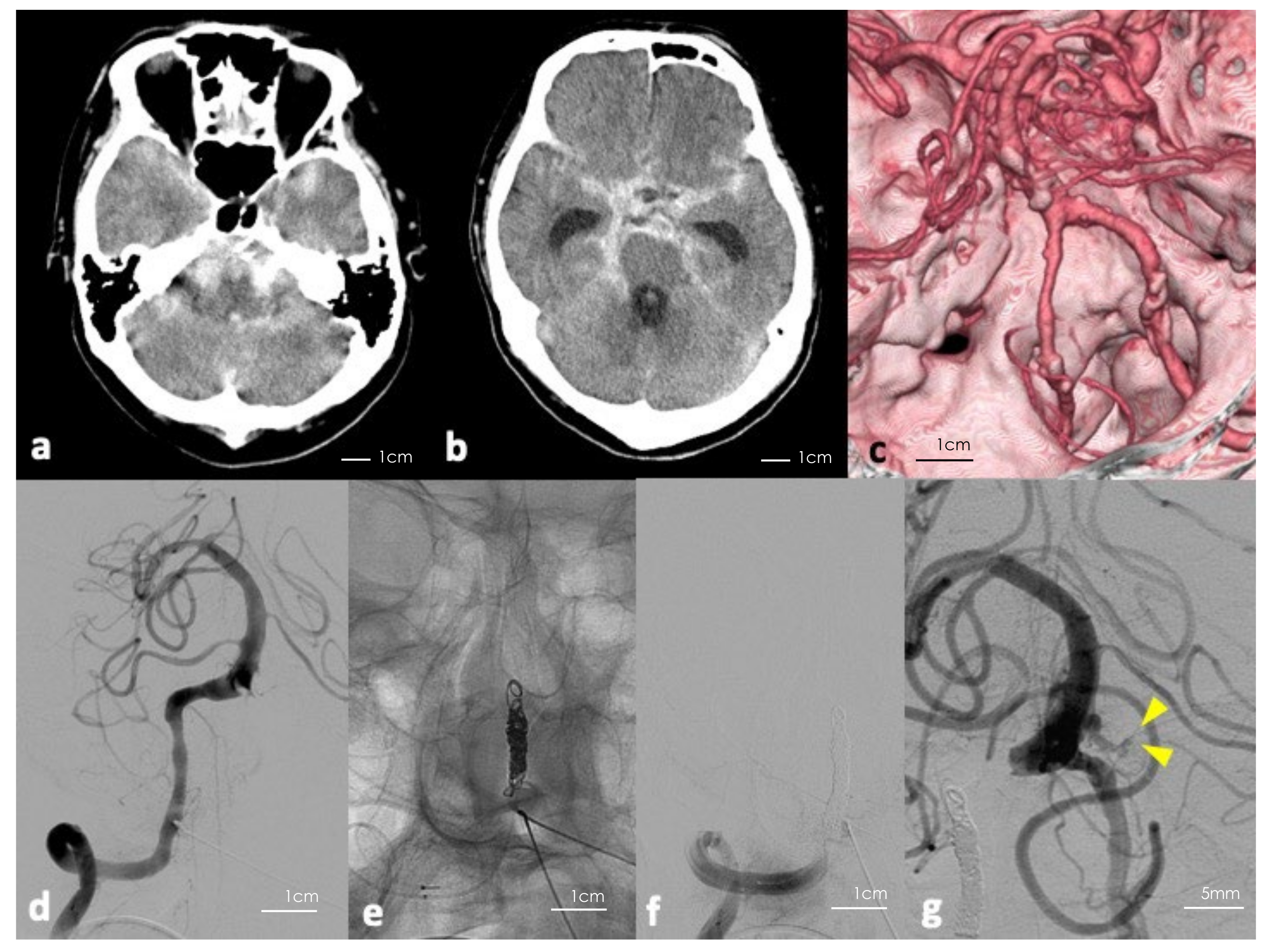 Surgeries 03 00038 g001