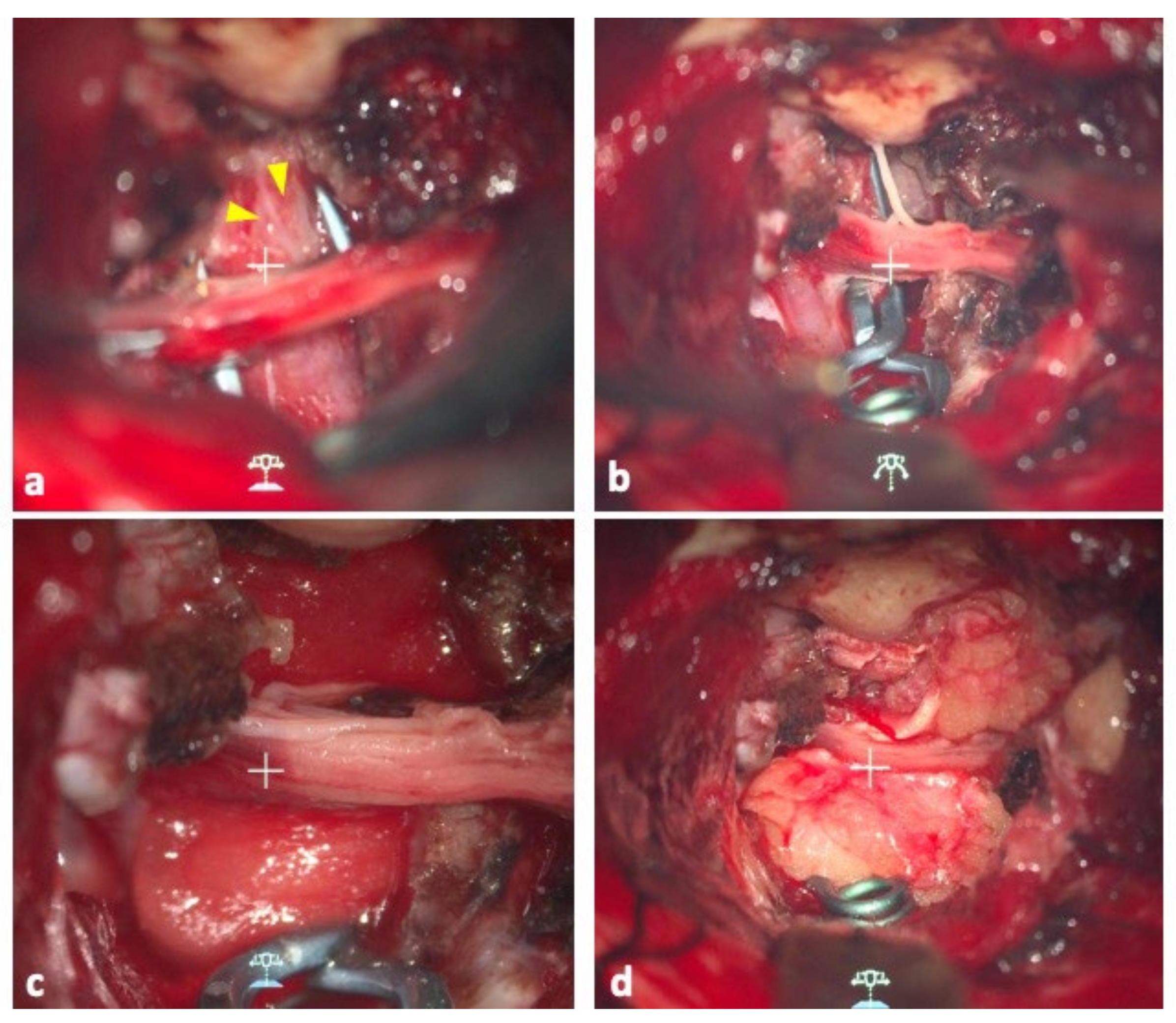 Surgeries 03 00038 g002