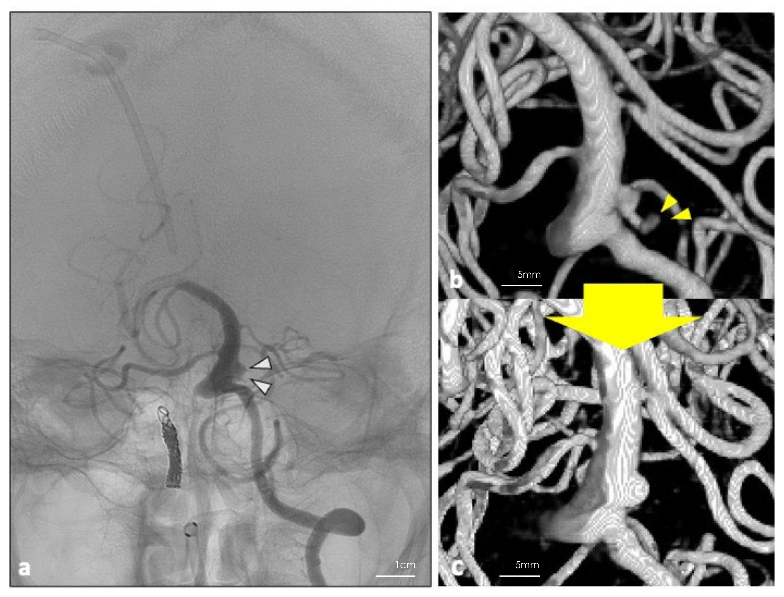 Surgeries 03 00038 g003