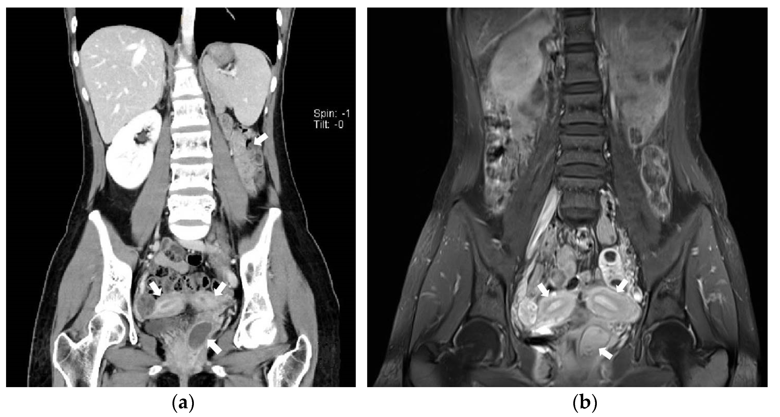 Surgeries 04 00002 g001